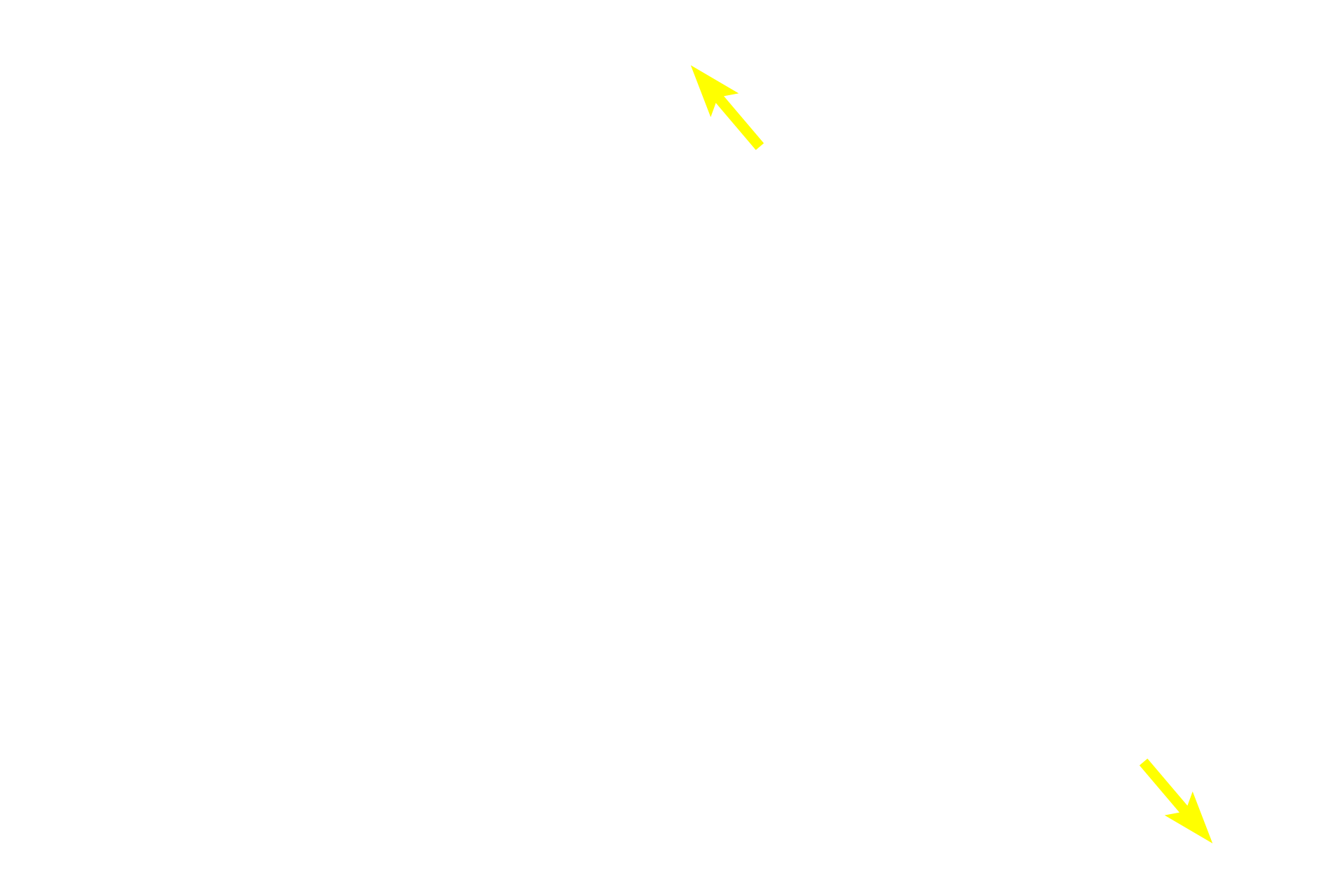 Lamina propria <p>Two folds of the oviductal mucosa of the ampulla are shown.  The simple columnar epithelium lining the oviduct possesses both ciliated and secretory cells, whose activity is regulated by ovarian hormones.  1000x</p>
