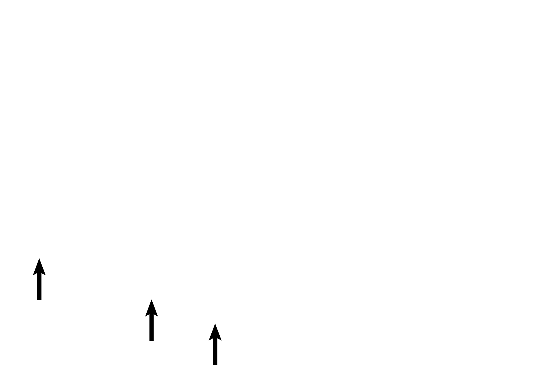 Germinal epithelium > <p>The germinal epithelium, the surface layer of the serosa, is located on the periphery of the ovary at the tips of the arrows. Tunica albuginea is the dense connective tissue layer beneath the serosa.</p>
