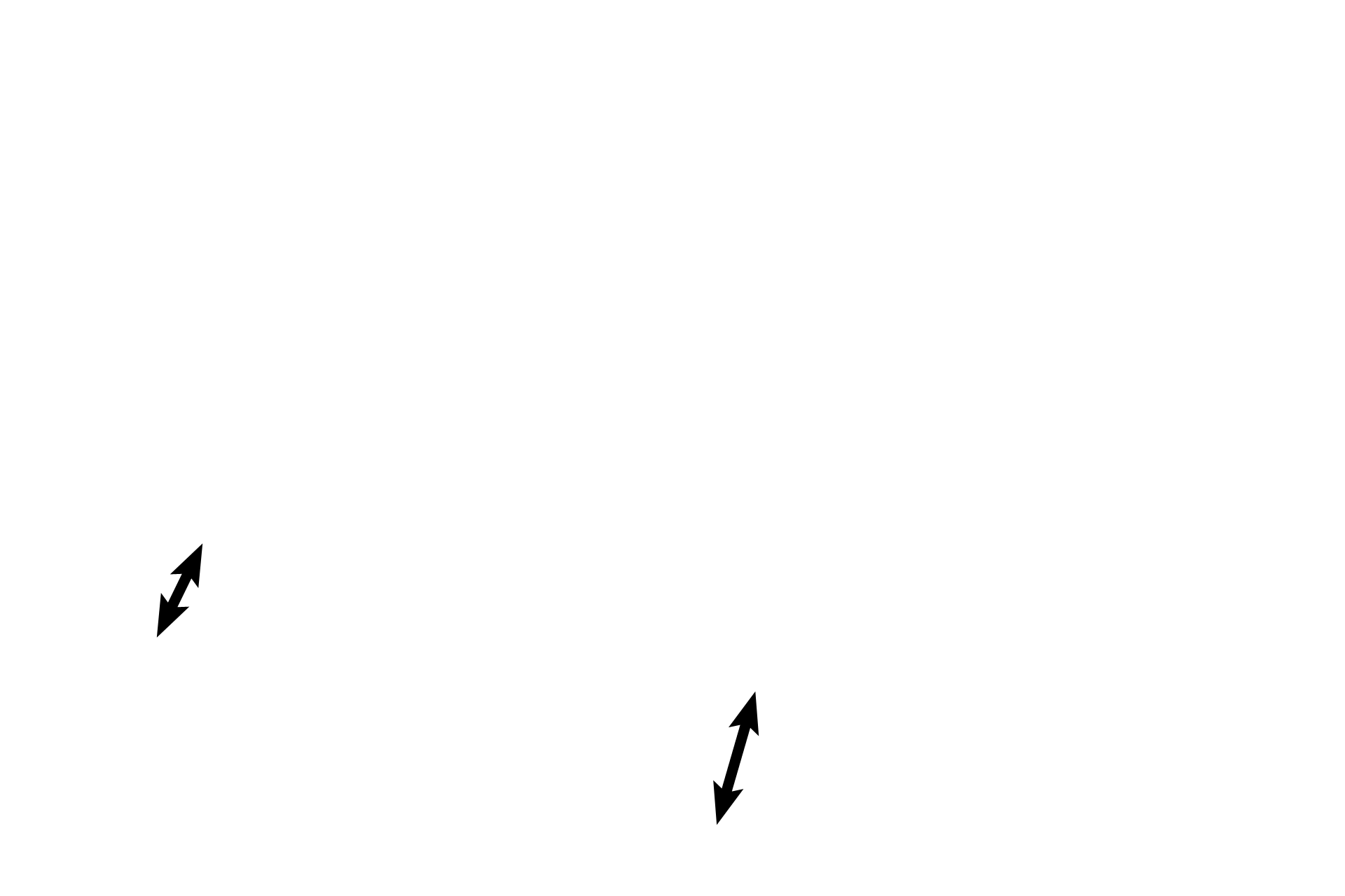 Tunica albuginea <p>The germinal epithelium, the surface layer of the serosa, is located on the periphery of the ovary at the tips of the arrows. Tunica albuginea is the dense connective tissue layer beneath the serosa.   </p>
