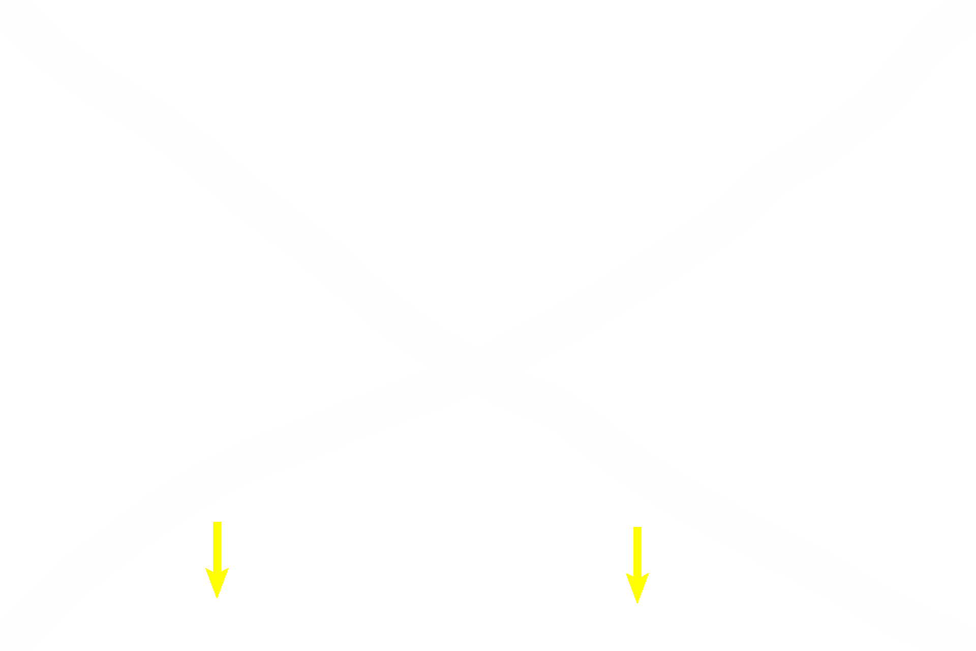 Germinal epithelium <p>Primordial follicles frequently appear in clusters near the surface of the ovarian cortex.  These follicles develop in fetal ovaries during gestation and are seen in this position throughout the reproductive life of the female. Primordial follicles consist of a primary oocyte surrounded by follicular cells, composed of a simple squamous epithelium and its underlying basement membrane.  400x </p>
