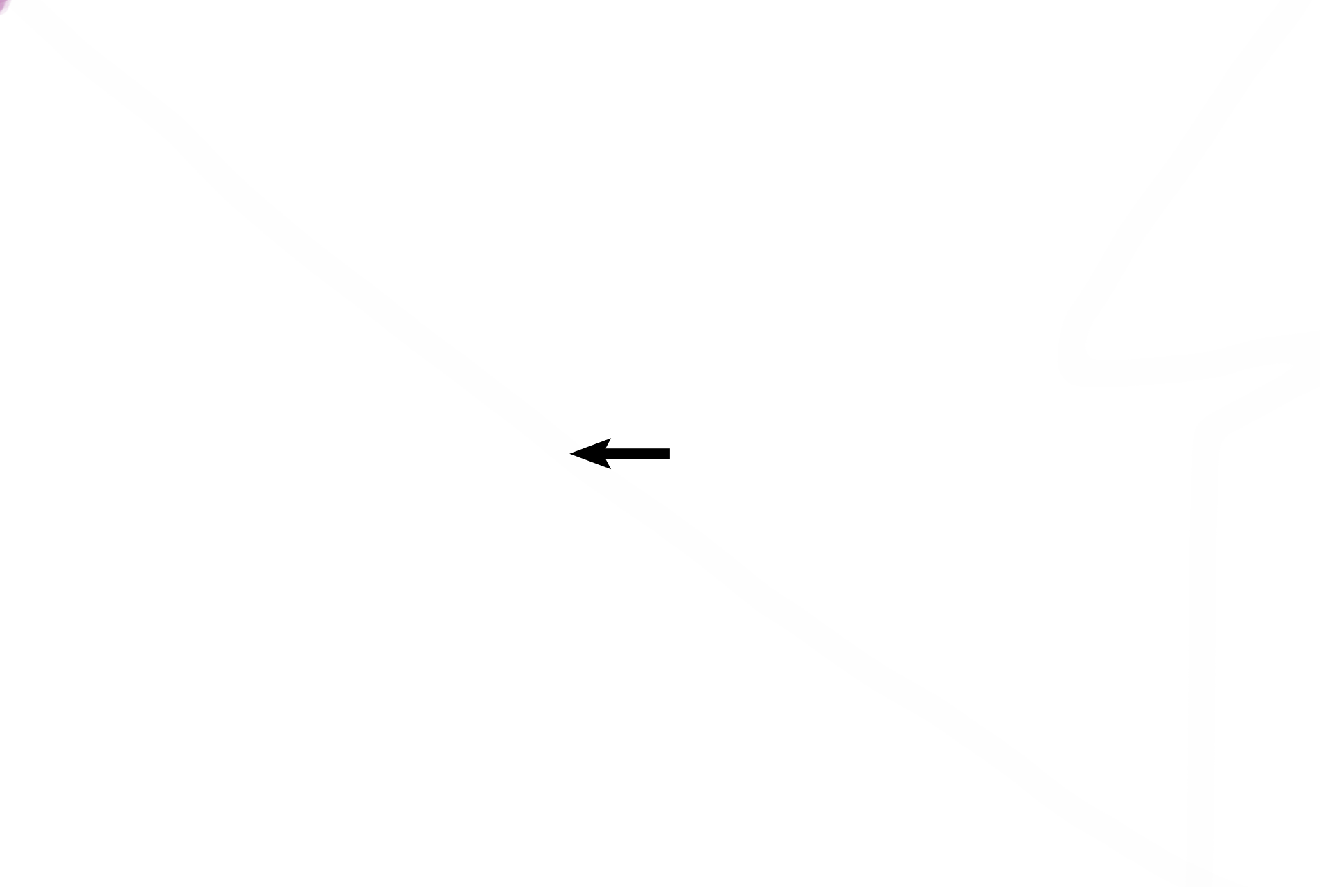 Primary oocyte <p>A primary multilaminar follicle is formed when follicular cells, now termed granulosa cells, increase in volume and number, forming a stratified epithelial layer.  Zona pellucida, a highly refractile, glycoproteinaceous layer, is prominent around the oocyte at this stage.  Stromal cells surrounding the follicle differentiate into the theca (theca folliculi).  400x</p>
