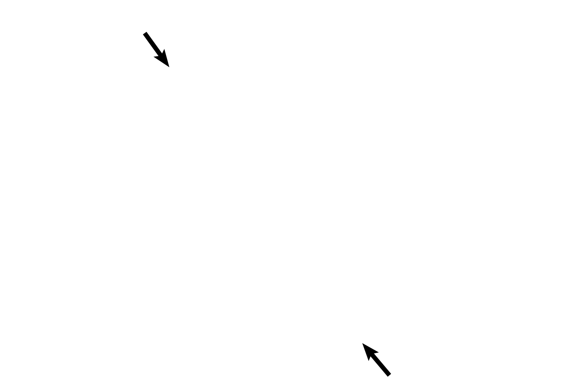 Theca externa <p>The secondary follicle continues to grow, its multiple antral spaces coalescing into a single antrum.  The primary oocyte remains arrested in prophase of the first meiotic division.  It is surrounded by a ring of granulosal cells (the cumulus oophorus) and protrudes into the antral space.  400x </p>
