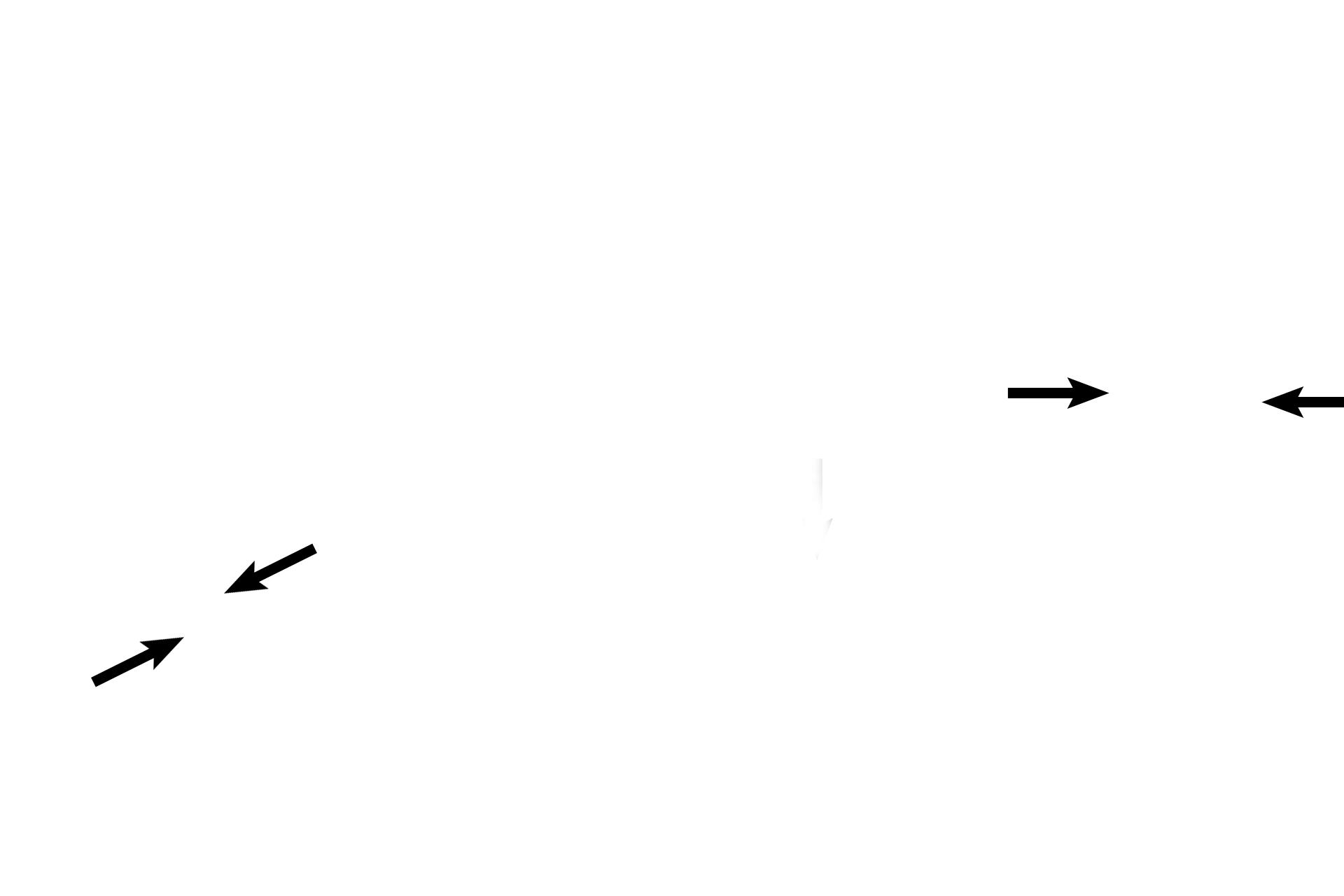 Corona radiata <p>The primary oocyte, arrested in prophase of the first meiotic division, is surrounded by the zona pellucida.  Stratum granulosal cells form a hillock surrounding the oocyte, termed the cumulus oophorus; the first row of cumulus cells outside the zona pellucida is the corona radiata.  The cumulus oophorus, including the corona, accompanies the oocyte during ovulation.</p>
