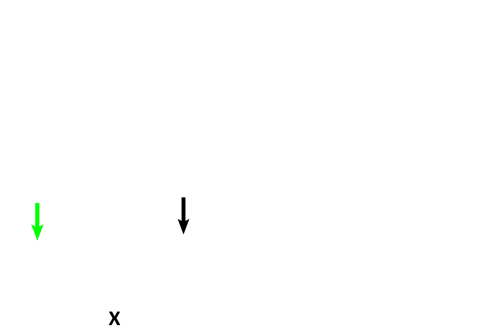Frame C > <p>Three atretic follicles can be seen.  An atretic secondary follicle (X) displays granulosa cells sloughing into the antrum.  On the left (green arrow), the granulosal cells have disappeared, leaving the remnants of the oocyte and its zona pellucida denuded. The black arrow indicates the zona pellucida of another follicle; the remainder of this follicle has degenerated. </p>
