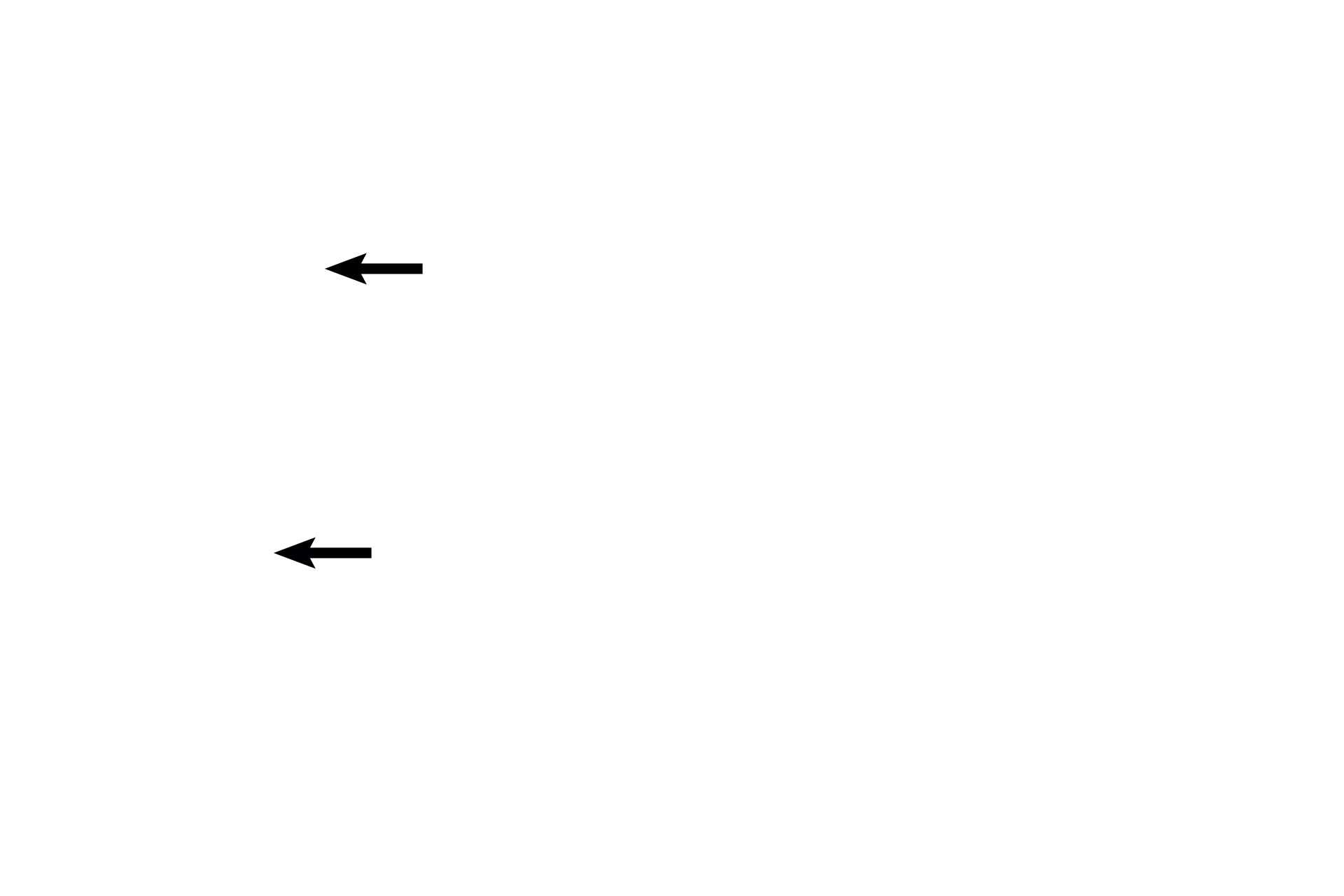  - Stem villus > <p>Stem villi originate from the chorionic plate.  Numerous, branching villi, termed floating villi, extend from each stem villus into the intervillous space, where they are bathed by maternal blood.</p>
