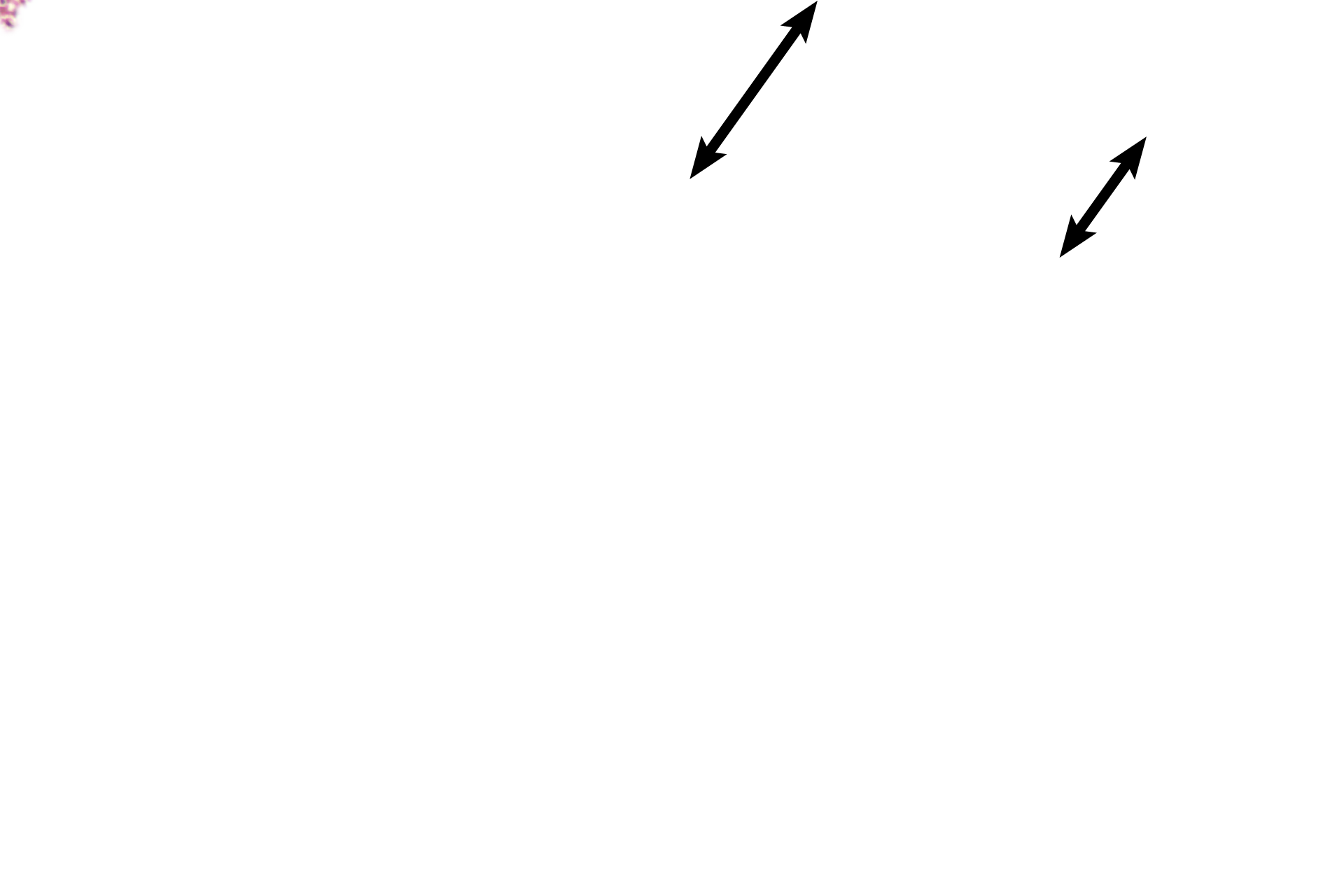 Chorionic plate > <p>The chorionic plate, attached to the amnion (not present here) encompassing the embryo, is composed of extraembryonic connective tissue covered by trophoblastic epithelium.  The two layers of the trophoblast cannot be differentiated at this magnification.   </p>
