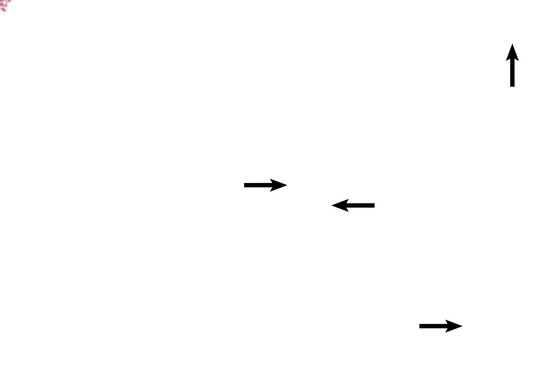 Embryonic blood vessels > <p>Embryonic blood vessels travel through stem villi to supply capillary beds located in the floating villi.  Floating villi fill the intervillous space, where they are bathed in maternal blood.</p>
