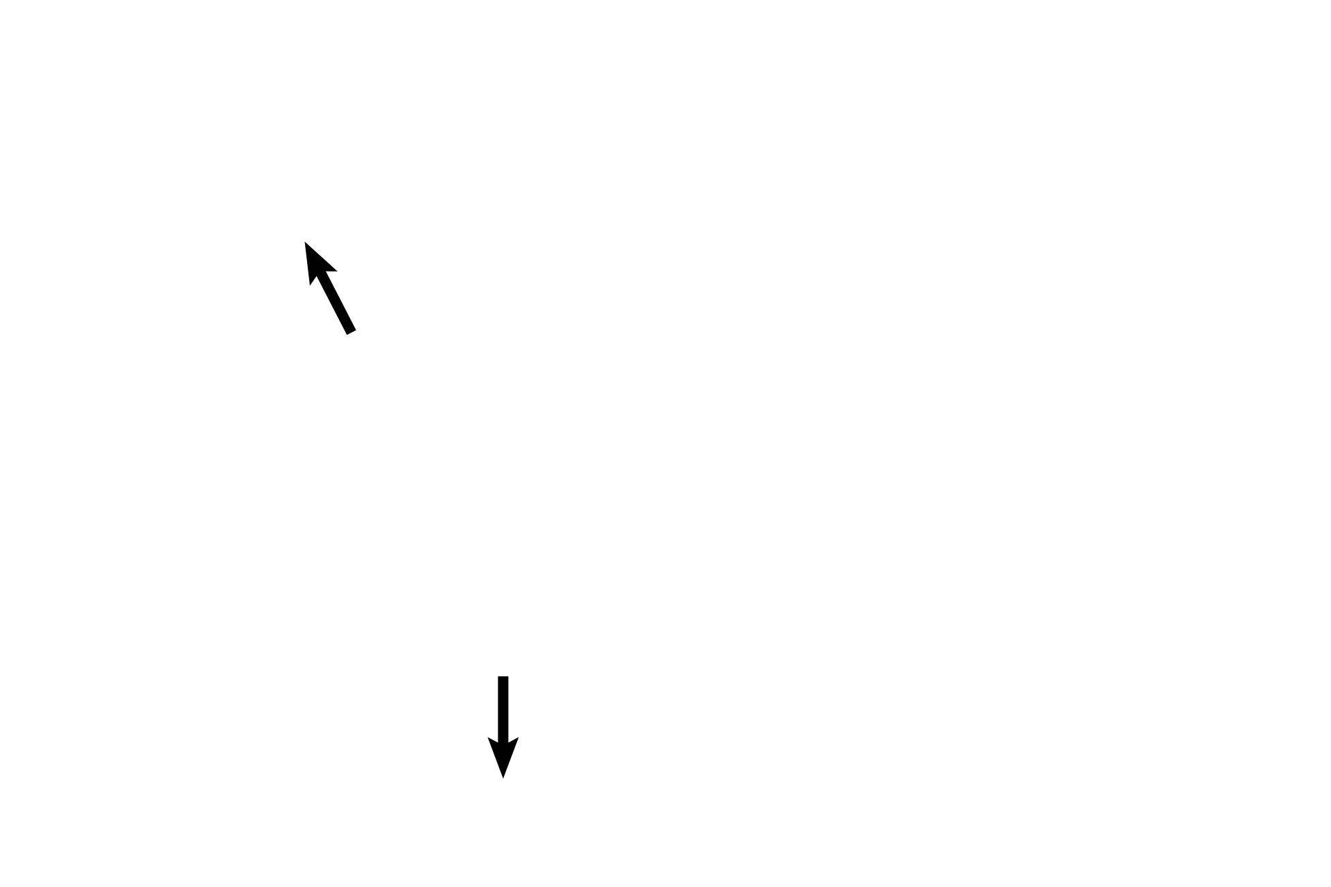  - Clumped nuclei <p>Villi appear similar to those in the early placenta except that fetal connective tissue is more condensed; cytotrophoblast cells form a discontinuous layer beneath the syncytiotrophoblast; fibrinoid is seen in villi; and syncytiotrophoblastic nuclei tend to clump.  Fetal capillaries are more numerous and are frequently located immediately beneath the syncytial layer.  400x</p>

