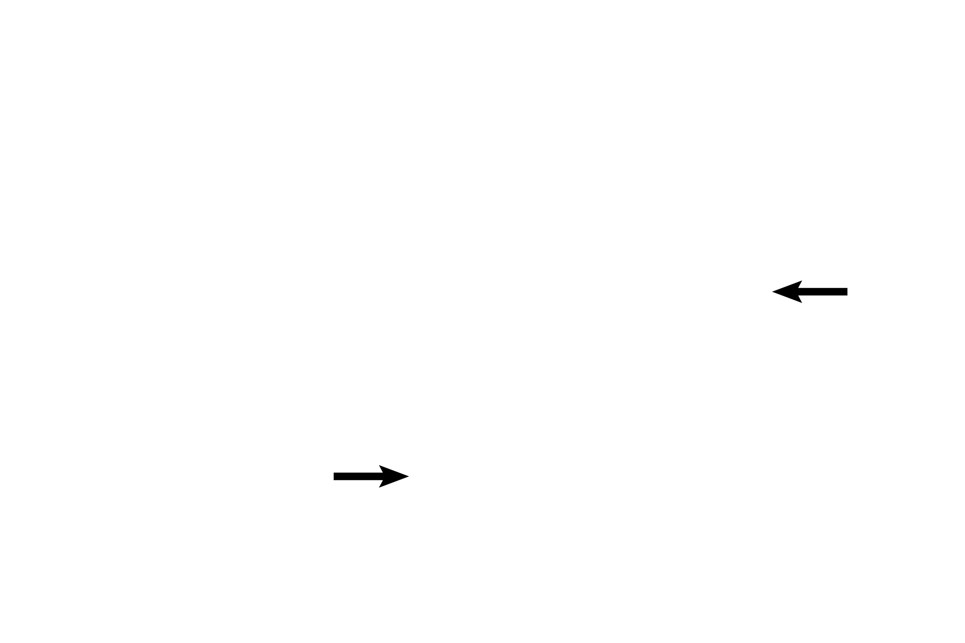 Umbilical arteries <p>Fetal blood in carried from the fetus to the placenta via two umbilical arteries in the umbilical cord. This blood is primarily deoxygenated blood that is high in wastes. A single umbilical vein returns oxygenated blood, high in nutrients, from the placenta to the fetus. The vessels are surrounded by mucous connective tissue, a multipotential fetal connective tissue. 10x</p>
