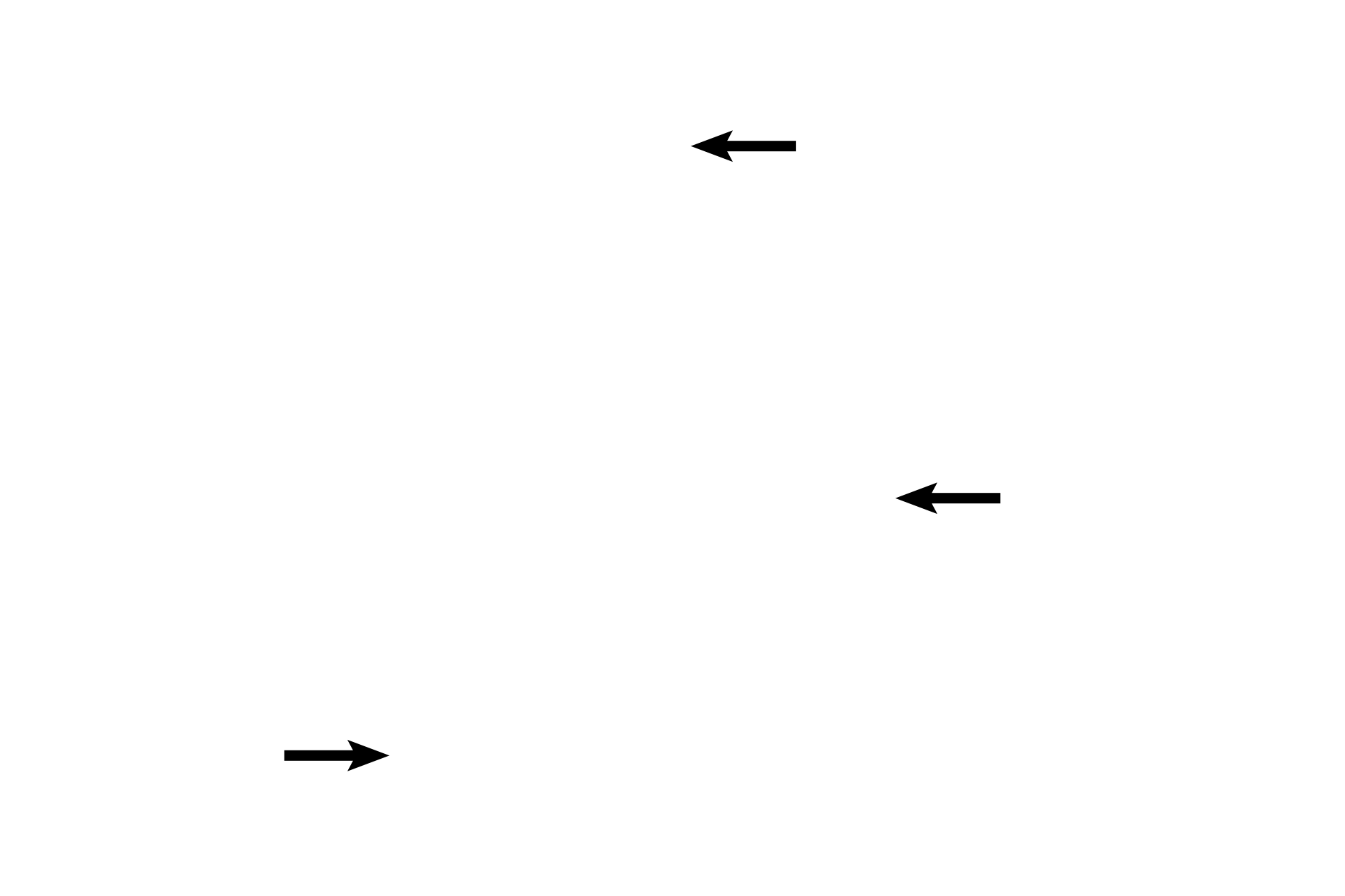 Mucous connective tissue <p>Fetal blood is conveyed from the fetus to the placenta via two umbilical arteries in the umbilical cord. This blood is primarily deoxygenated blood that is high in wastes. A single umbilical vein returns oxygenated blood, high in nutrients, from the placenta to the fetus. The vessels are surrounded by mucous connective tissue, a multipotential fetal connective tissue. 10x</p>
