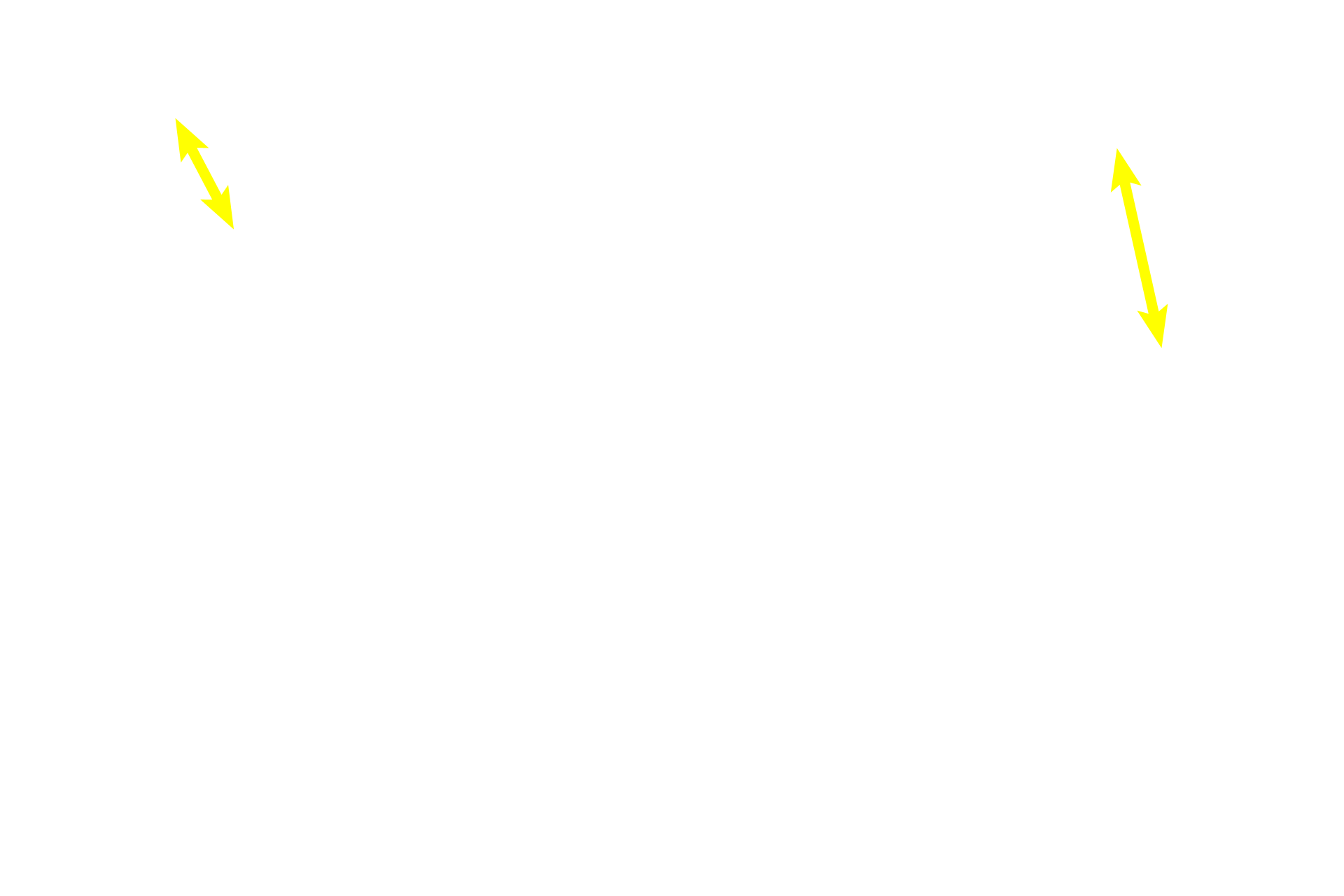 Functional zone <p>The secretory phase begins following ovulation. Uterine glands are actively secreting and the corpus luteum in the ovary is secreting progesterone and estrogen.  During the early portion of the secretory phase (shown here), the endometrium is thicker than during the proliferative stage and the glands are more sacculated; spiral arteries are present, but are not highly coiled. 10x, 10x</p>
