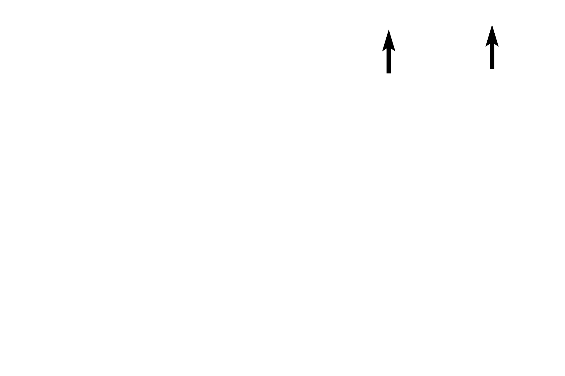 Surface epithelium <p>When the ischemic tissue in the functional zone loses its integrity, it is sloughed as menstruation. This image, taken from early in the menstrual phase, shows an intact surface epithelium on the right half of the image, while tissue has already begun to slough in other areas (left half).  100x</p>
