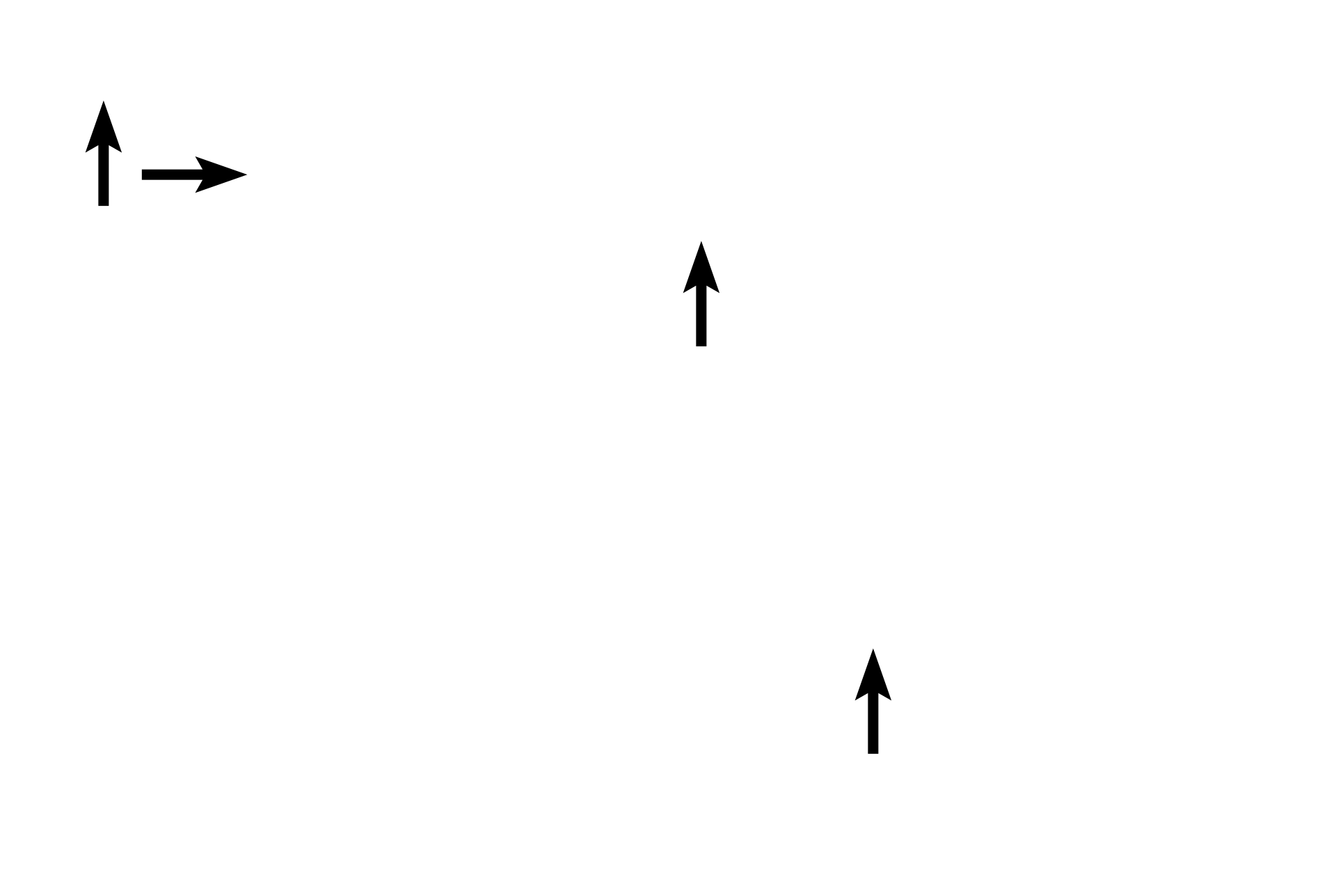 Glands <p>Sloughing of the functional zone has already begun, as evidenced by the lack of surface epithelium, presence of glands at the luminal surface, and missing portions of the functional zone.  The thickness of the remaining functional zone indicates that this tissue was taken during the early days of the menstrual phase.  100x</p>
