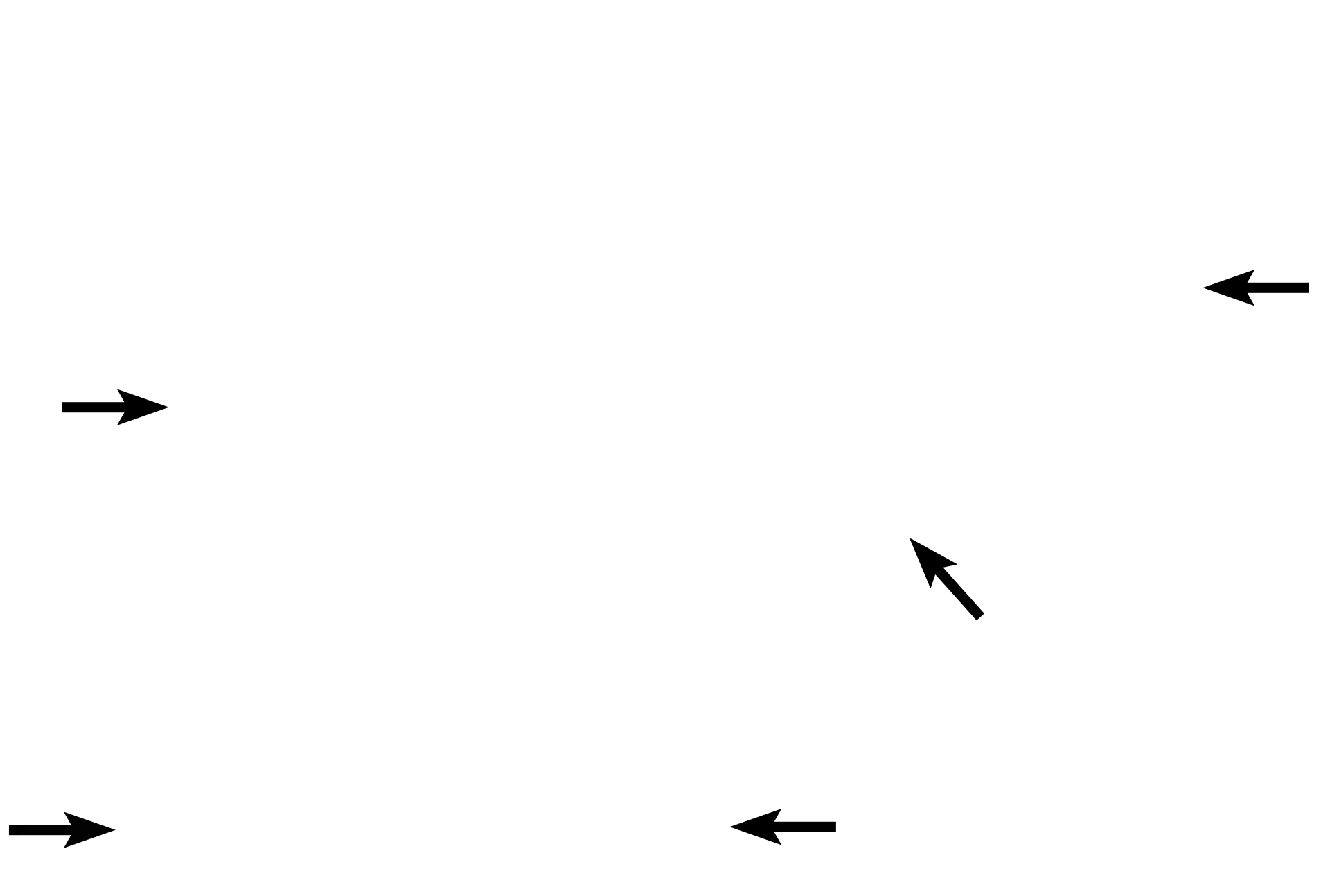 Vagina > <p>The vagina forms a right angle with the anteverted uterus, creating pouches (fornices) around the protruding cervix. The vaginal walls are usually collapsed; numerous rugae allow for distension during parturition. The vagina is lined by a stratified squamous moist epithelium, and an extensive plexus of thin-walled blood vessels is located in the subepithelial connective tissue.</p>
