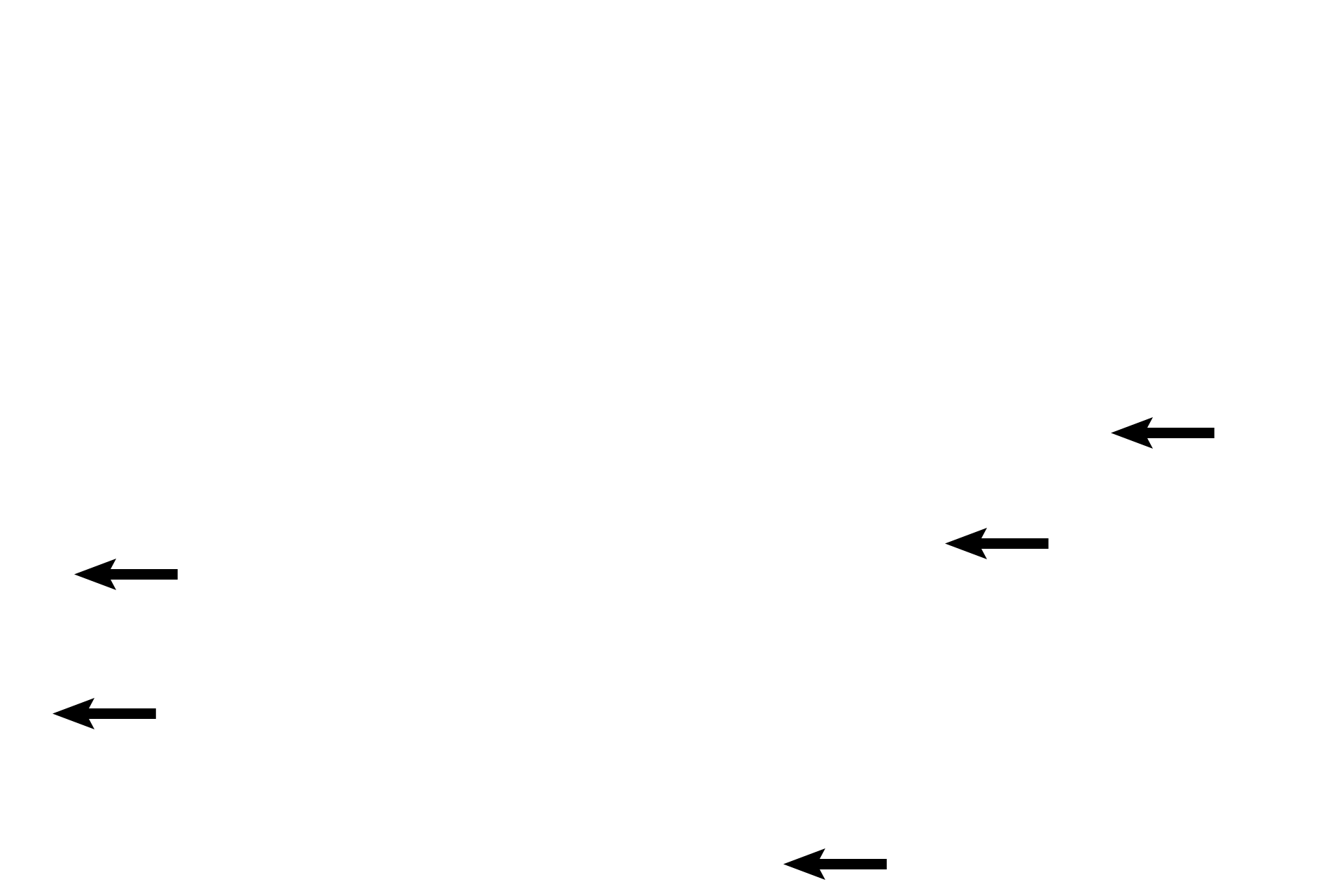  - Blood vessels <p>The vagina forms a right angle with the anteverted uterus, creating pouches (fornices) around the protruding cervix. The vaginal walls are usually collapsed; numerous rugae allow for distension during parturition. The vagina is lined by a stratified squamous moist epithelium, and an extensive plexus of thin-walled blood vessels is located in the subepithelial connective tissue.</p>
