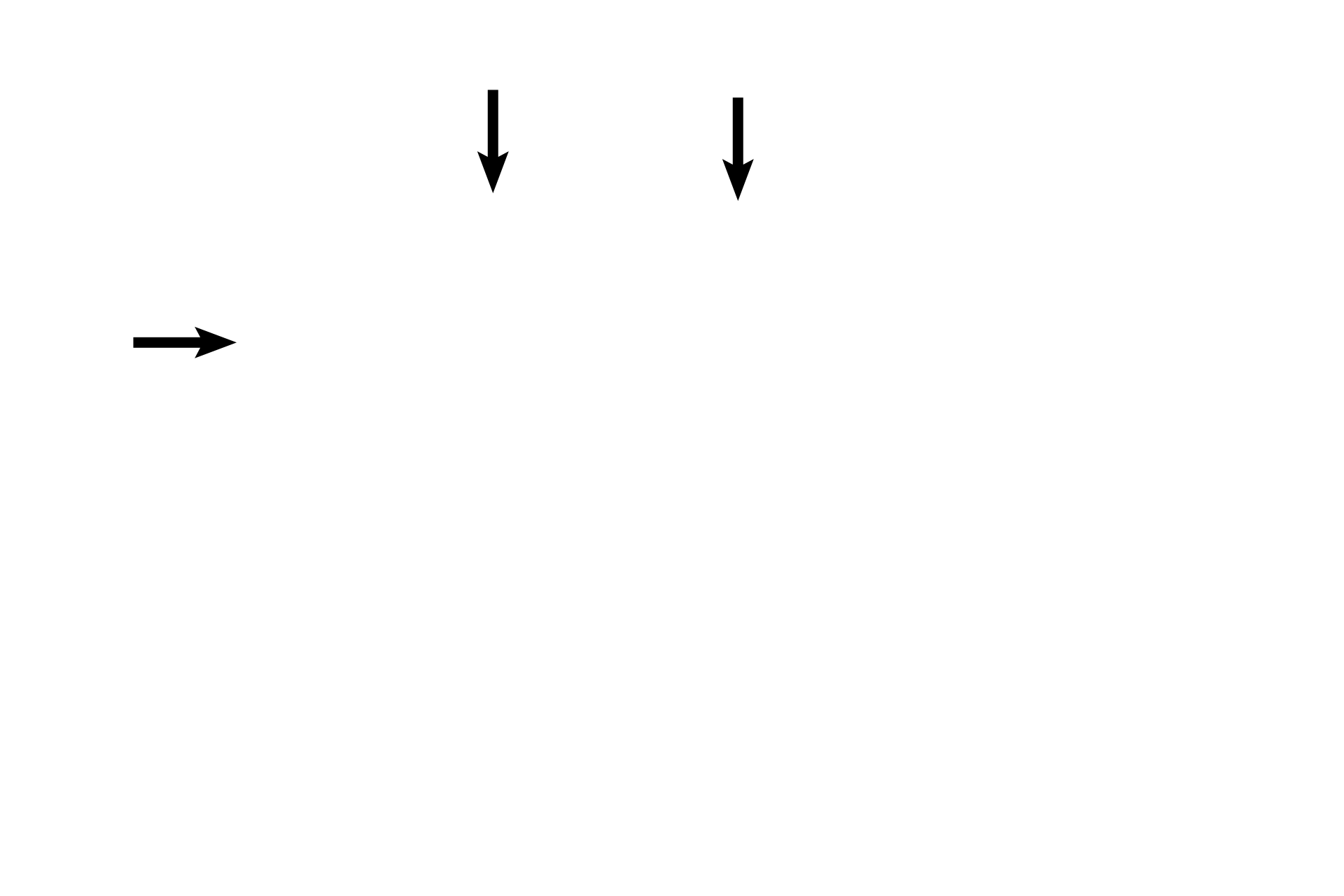  - Stratified squamous moist epithelium  <p>The ectocervix extends from the external os and protrudes into the vagina. Stratified squamous moist epithelium covers the ectocervix (vaginal portion of the cervix) and cannot be differentiated from vaginal epithelium.  </p>
