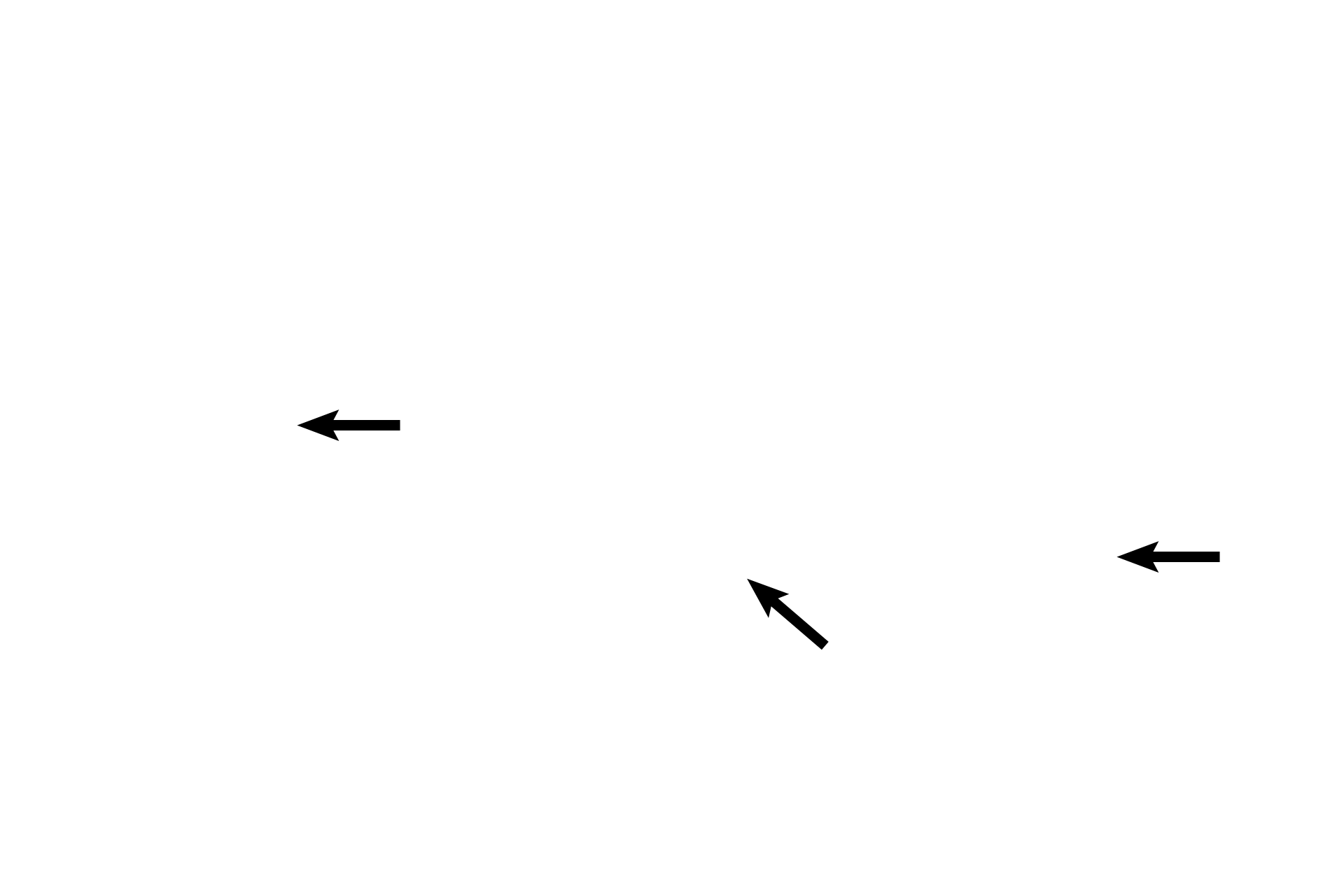 Mucous secretions <p>The external os is the junction of the epithelium lining the endocervical canal with that lining the ectocervix. (See box in inset for orientation.) The position of the external os migrates with the reproductive status of the female. 40x, 100x</p>
