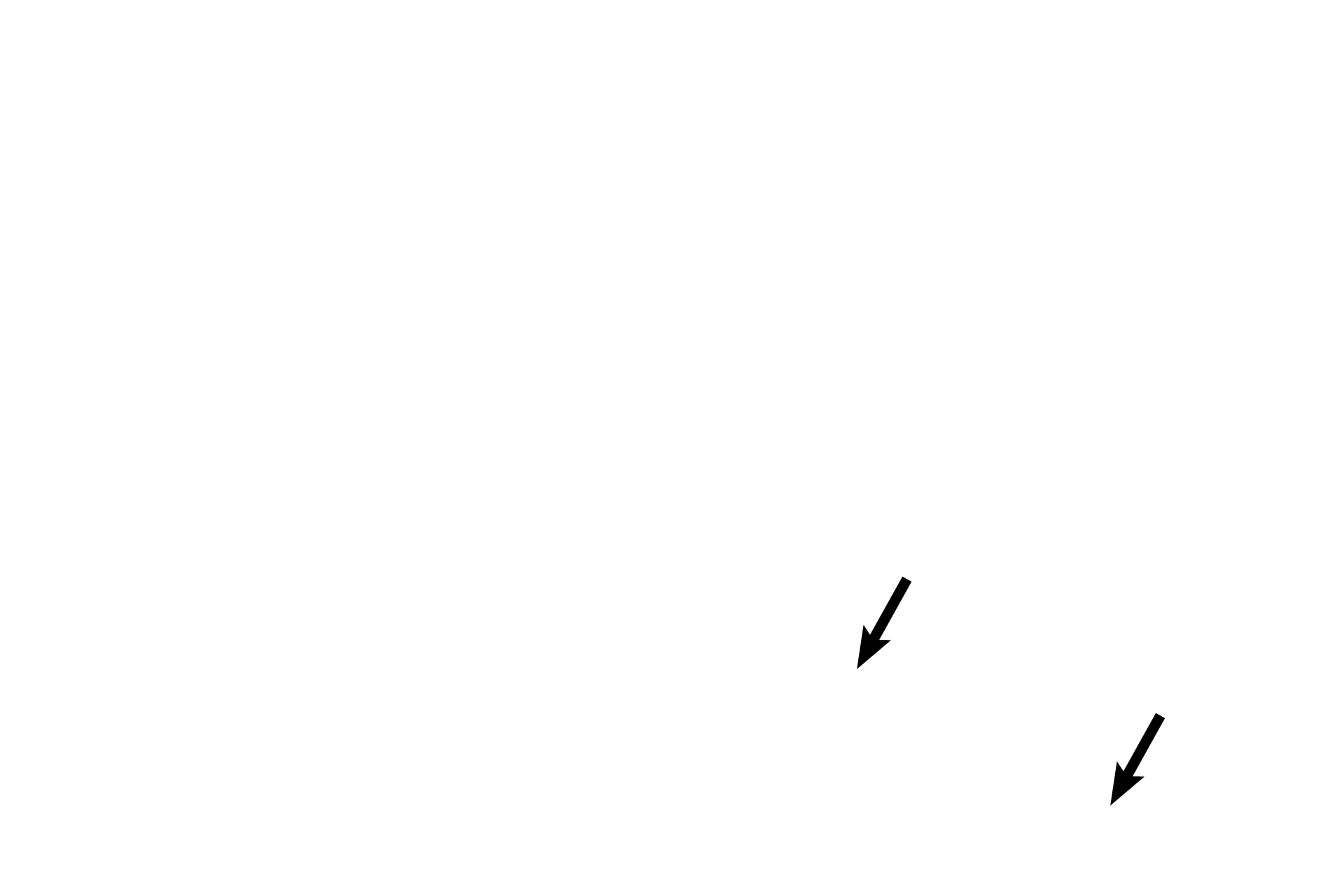 Simple columnar epithelium <p>The external os is the junction of the epithelium lining the endocervical canal with that lining the ectocervix. (See box in inset for orientation.) The position of the external os migrates with the reproductive status of the female. 40x, 100x</p>
