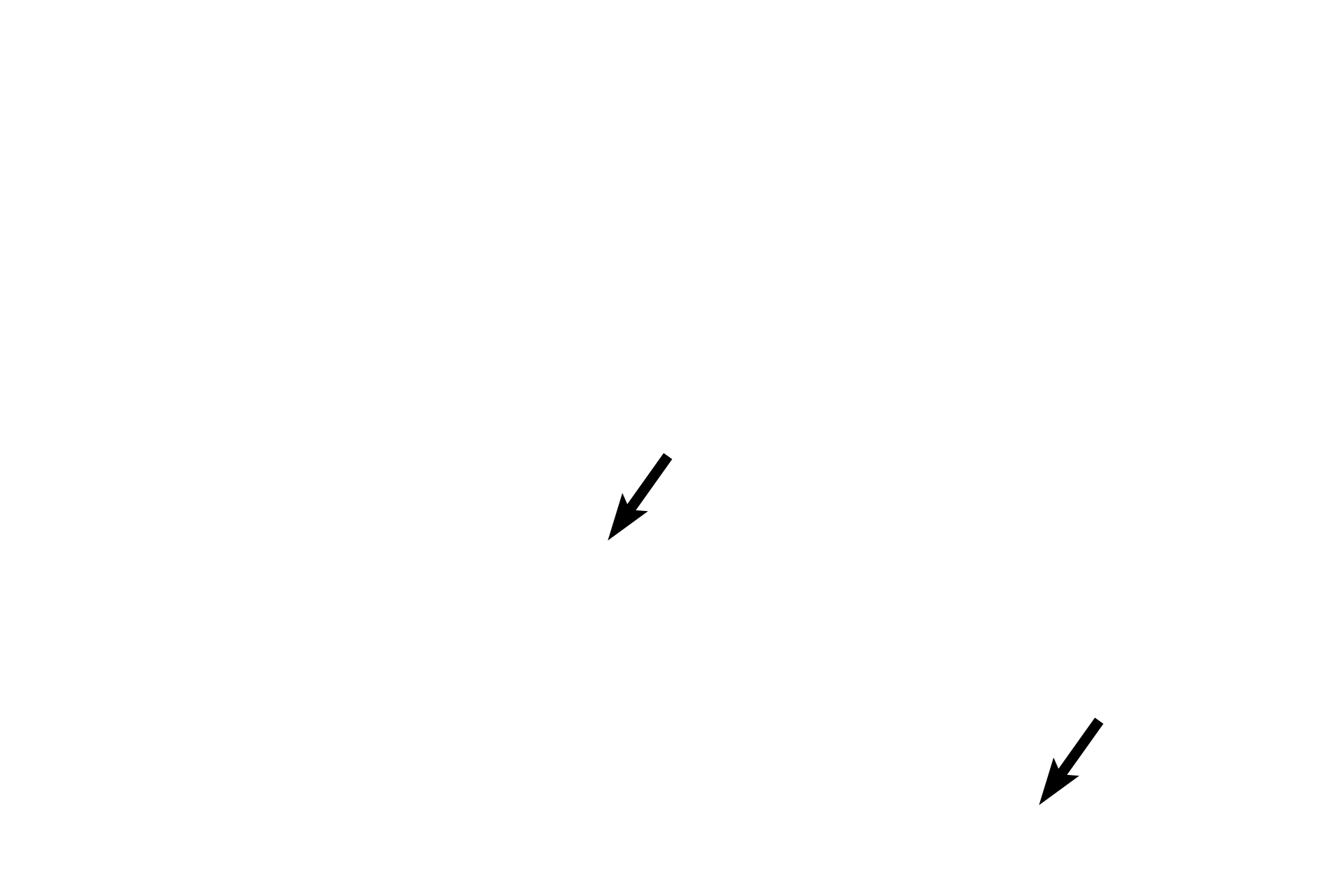 Mucus <p>The plicae palmatae are palm-frond shaped folds that penetrate cervical connective tissue from the epithelium lining the endocervical canal. These folds secrete abundant mucus at the time of ovulation, under the influence of estrogen secreted by ovarian follicles. 200x</p>
