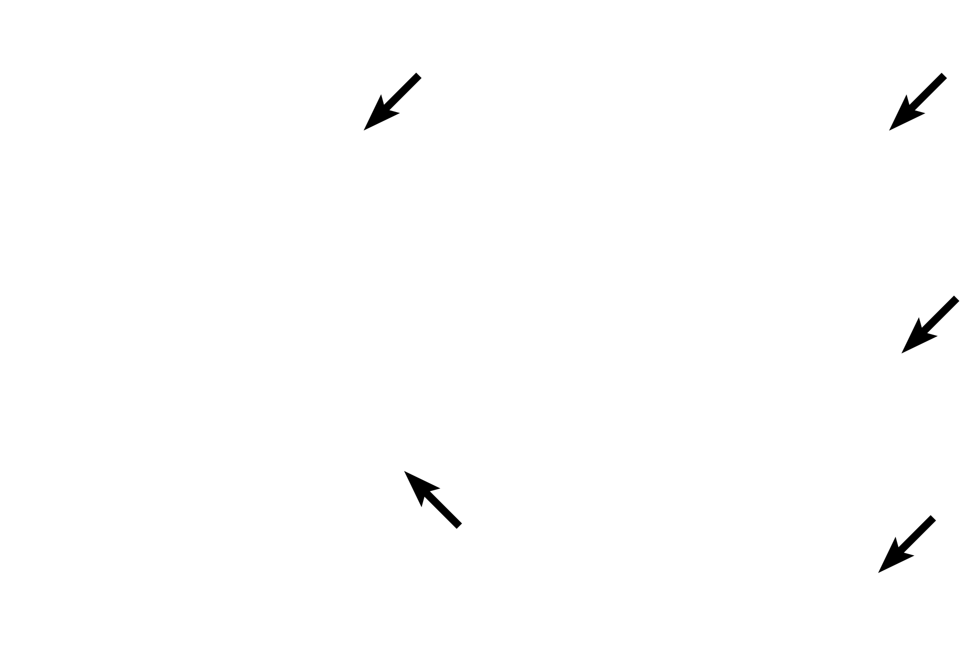  - Epithelium (mesothelium) <p>A serosal membrane (serosa) lines internal body cavities, forming a parietal layer around the cavity’s inner wall and a visceral layer over organs protruding into the cavity.  A serosa is composed of simple squamous epithelium (mesothelium) overlying a layer of connective tissue.  Examples of serosal membranes are pleural, pericardial and peritoneal membranes identified in gross anatomy.  200x, 1000x</p>
