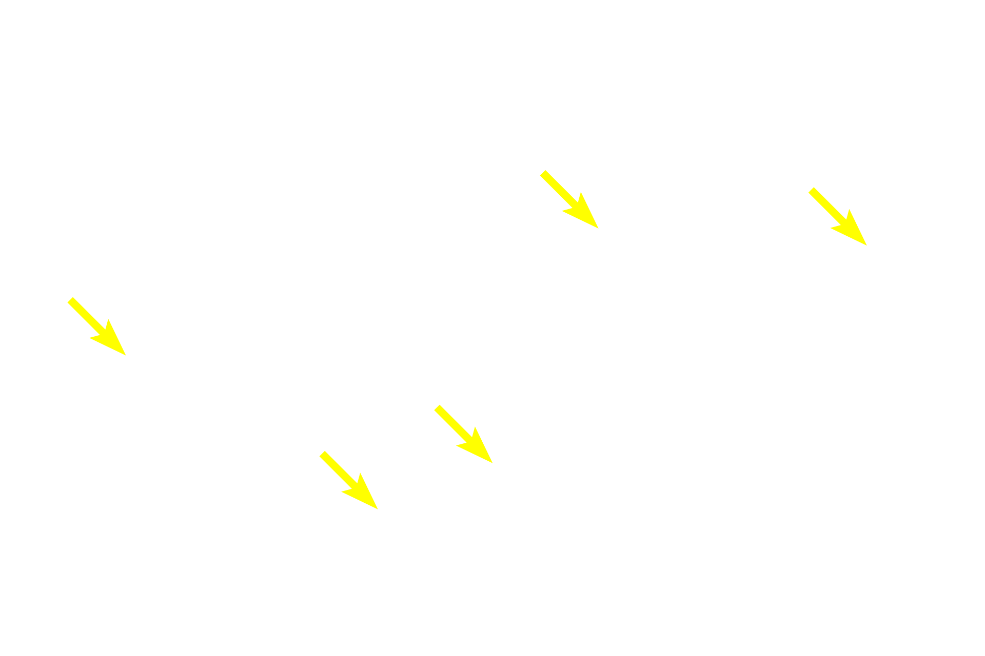 Parenchyma <p>In this section of the anterior pituitary gland, the hormone-secreting parenchymal cells are stained orange and blue.  The stroma of the gland is formed by collagen fibers, providing a sturdy framework for the organ.  This section is specially stained by the Masson method, which employs a collagen stain similar to that used in the trichrome stain.  The stroma also conveys blood vessels into the organ. 400x</p>
