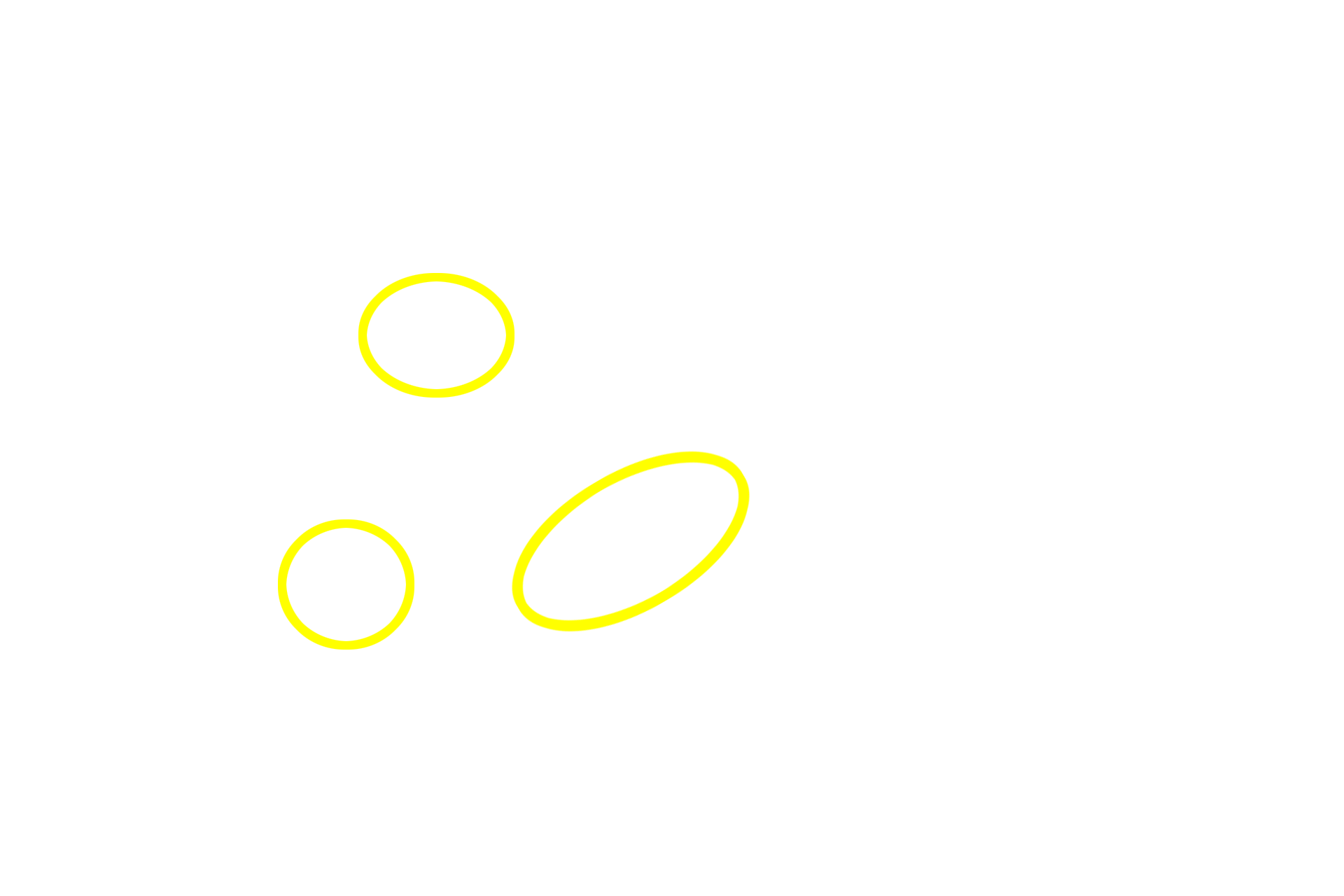 Blood vessels <p>In this section of the anterior pituitary gland, the hormone-secreting parenchymal cells are stained orange and blue.  The stroma of the gland is formed by collagen fibers, providing a sturdy framework for the organ.  This section is specially stained by the Masson method, which employs a collagen stain similar to that used in the trichrome stain.  The stroma also conveys blood vessels into the organ. 400x</p>
