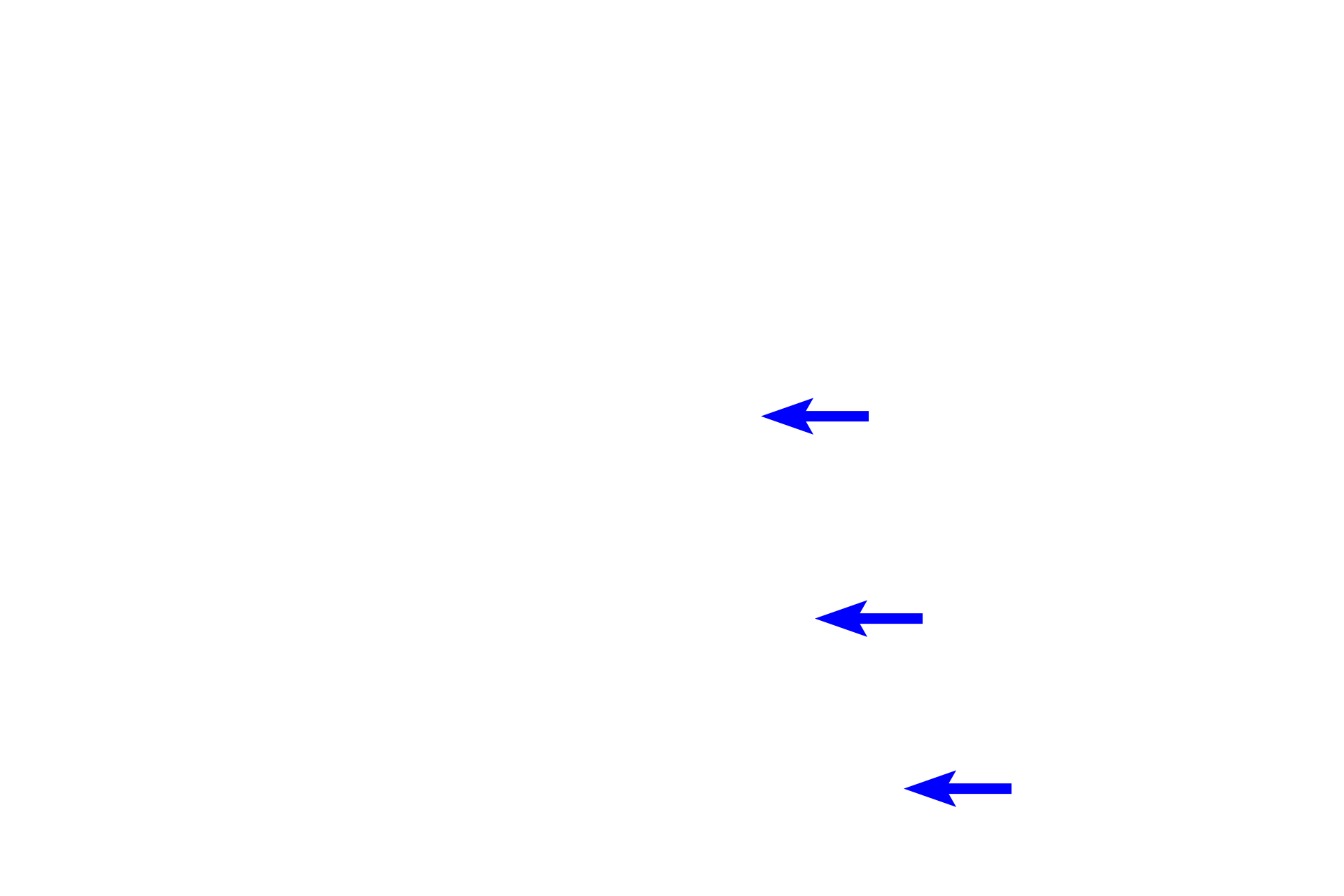 Stroma: trabeculum <p>The stroma often forms a dense connective tissue capsule that surrounds an organ, as seen in this section of the spleen.  Extensions from the capsule, called trabeculae, penetrate the organ to provide internal support.  The parenchyma of the spleen is formed of lymphoid cells which are supported by a stroma of delicate reticular connective tissue. 100x</p>
