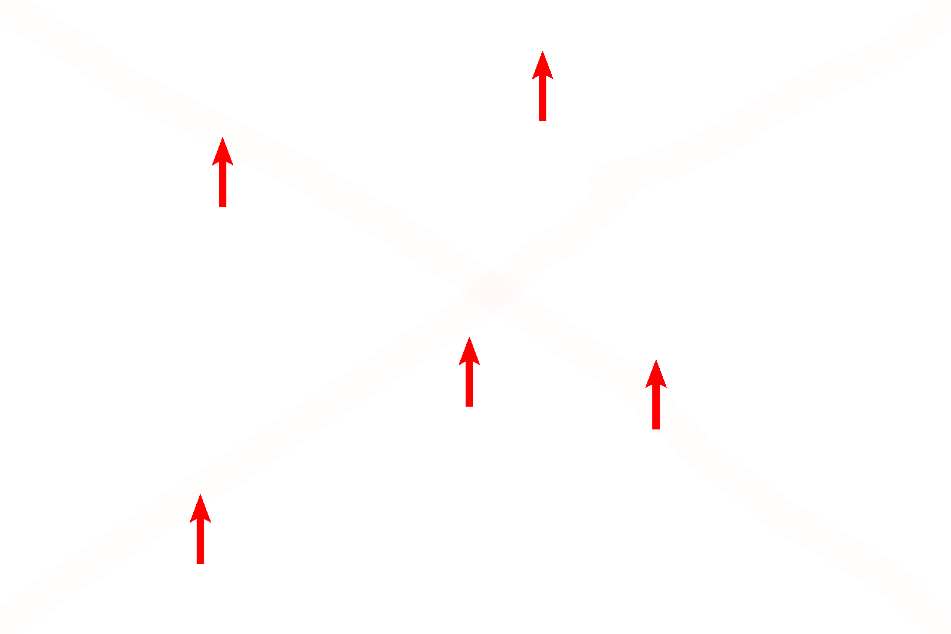 Chondrocytes <p>The qualities that distinguish elastic cartilage are quite evident here: numerous chondrocytes with few isogenous groups, less extracellular matrix than hyaline cartilage and abundant, very obvious elastic fibers. 600x</p>
