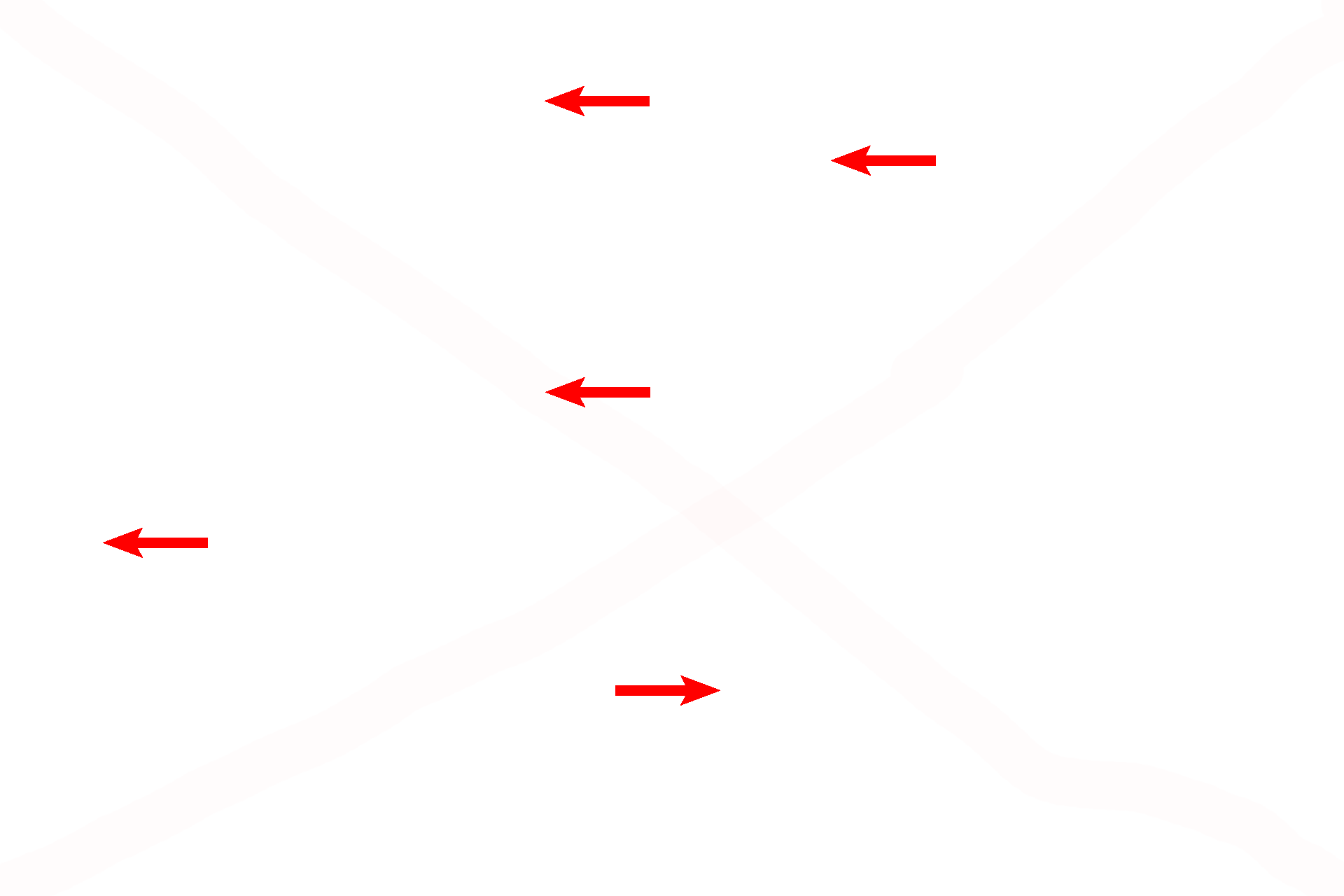 Chondrocytes <p>With a special stain, elastic fibers are readily visible in elastic cartilage, helping to differentiate it from hyaline cartilage. 1000x</p>
