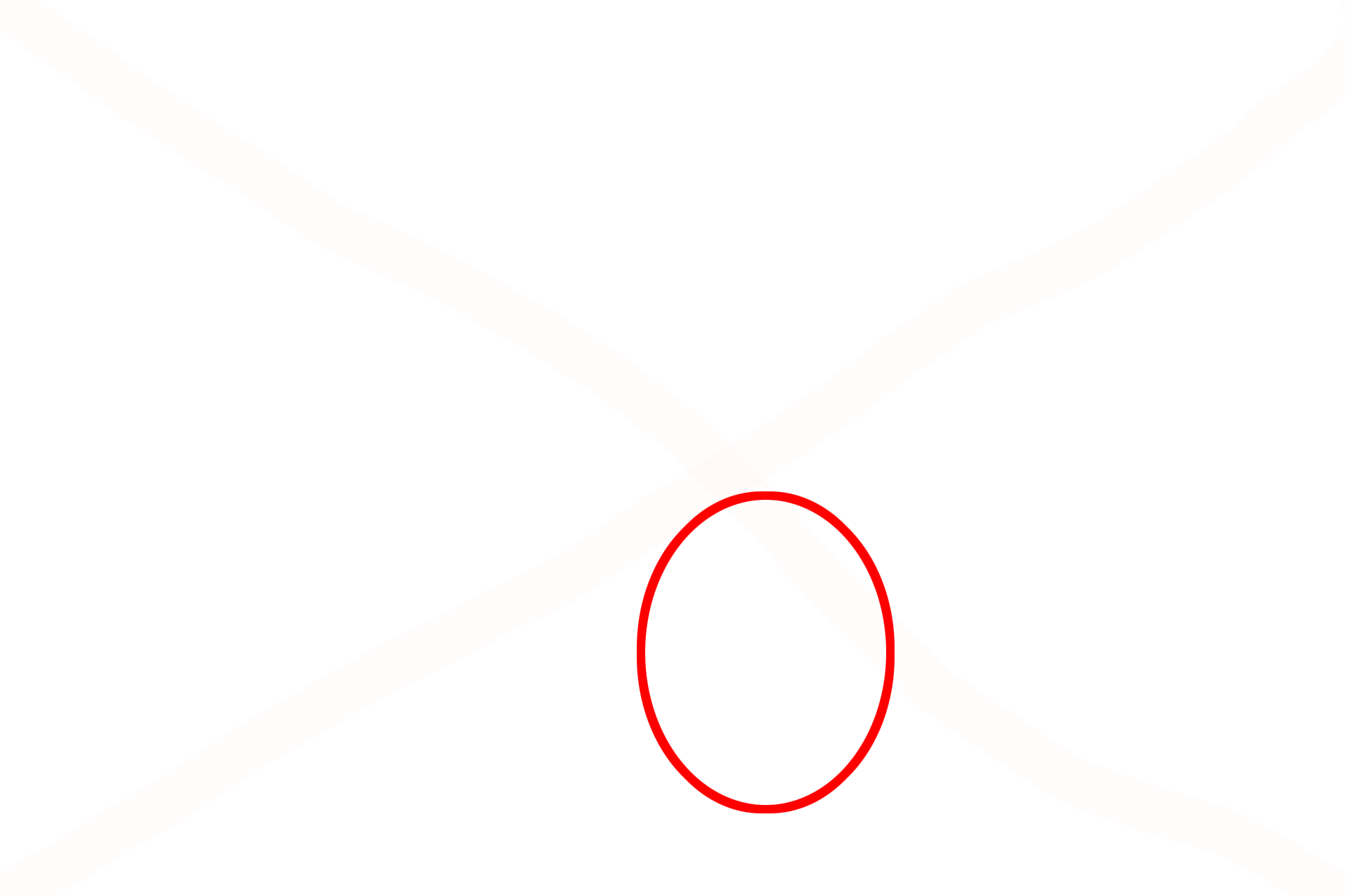 Isogenous group <p>With a special stain, elastic fibers are readily visible in elastic cartilage, helping to differentiate it from hyaline cartilage. 1000x</p>
