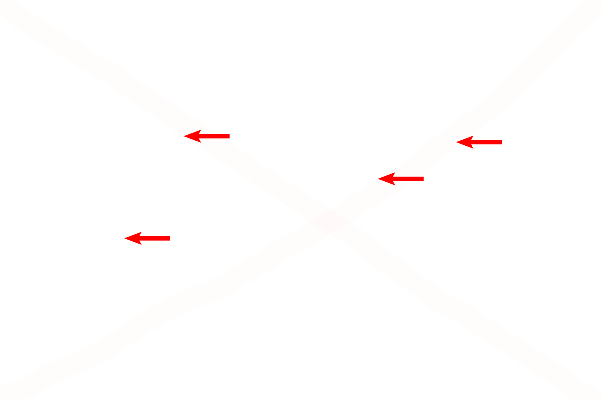 Elastic fibers <p>With a special stain, elastic fibers are readily visible in elastic cartilage, helping to differentiate it from hyaline cartilage. 1000x</p>
