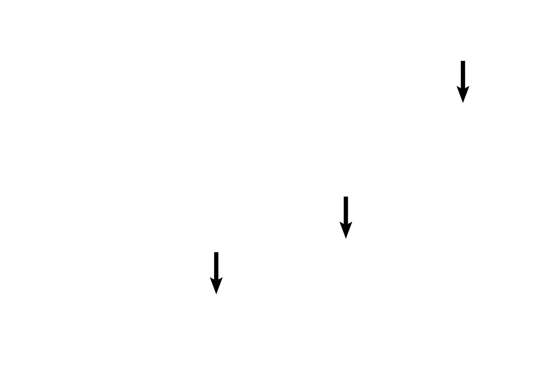  - Chondroblasts <p>Chondroblasts in the chondrogenic layer secrete cartilage matrix around themselves, becoming chondrocytes and increasing cartilage thickness by appositional growth, i.e., growth at the surface. The exact point at which a chondroblast becomes a chondrocyte is not a well defined junction. The transition between the inactive, flattened cells to plump, secretory chondroblasts to spherical chondrocytes is demonstrated.</p>
