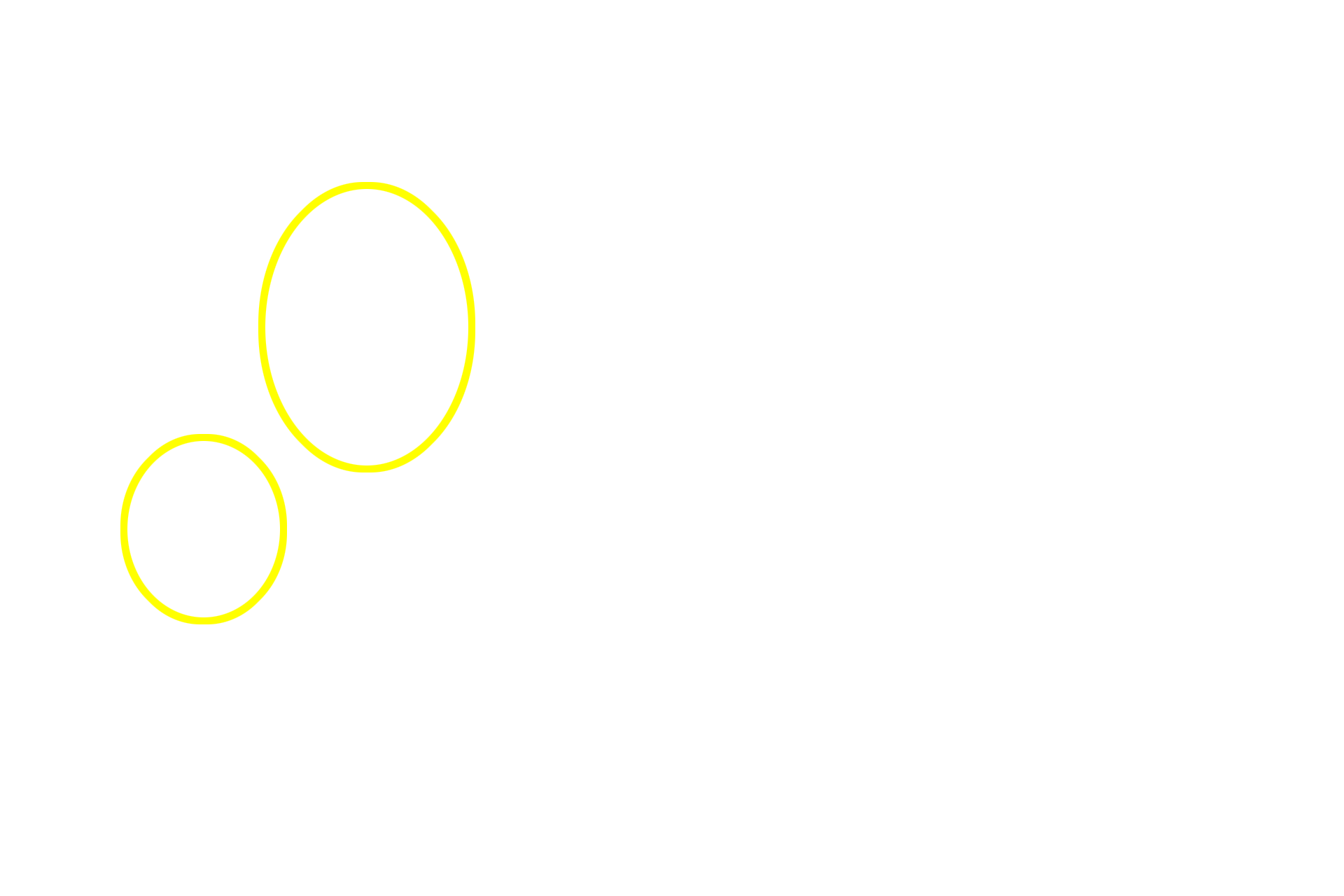  - Isogenous groups > <p>Chondrocytes divide within their lacunae forming isogenous groups.  Continued matrix deposition by these cells disperses them, adding to the interstitial growth.</p>
