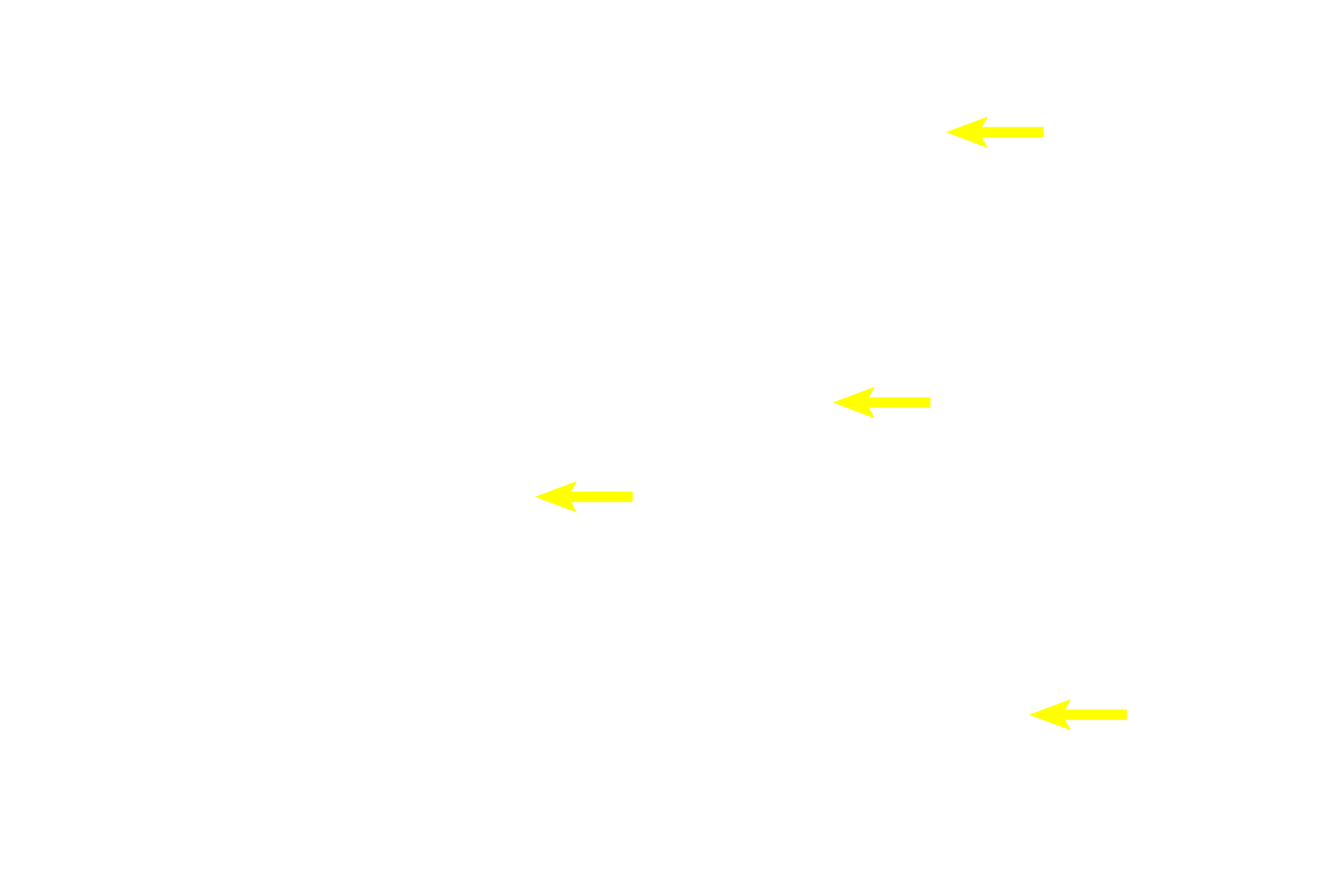 Chondrocytes <p>Hyaline cartilage is identified by its blue-purple appearance and by its isogenous groups of chondrocytes. The lack of blood vessels in hyaline cartilage means that nutrients and wastes must diffuse through the tissue, thus limiting the thickness of the hyaline cartilage. 400x</p>
