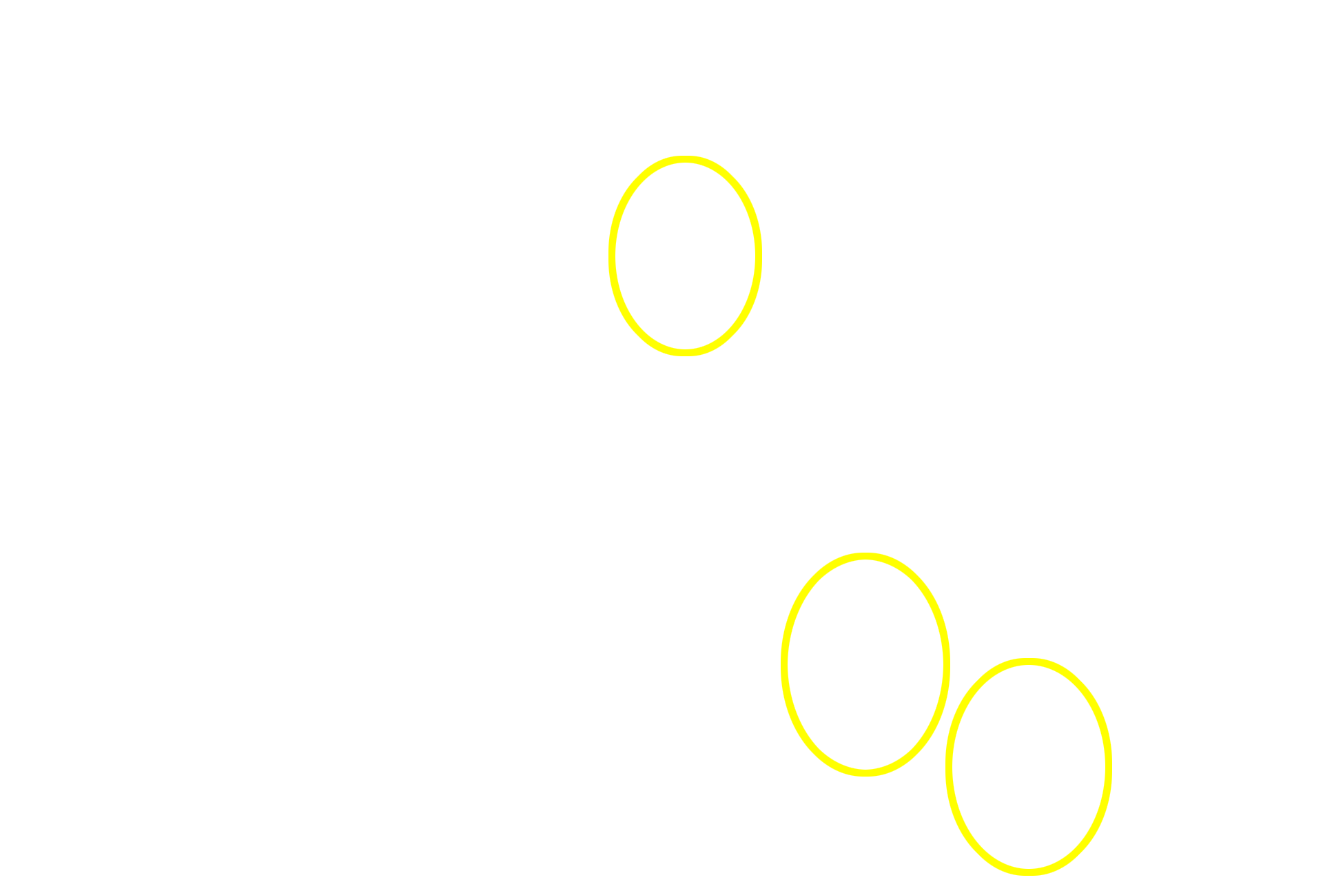 Isogenous groups <p>Hyaline cartilage is identified by its blue-purple appearance and by its isogenous groups of chondrocytes. The lack of blood vessels in hyaline cartilage means that nutrients and wastes must diffuse through the tissue, thus limiting the thickness of the hyaline cartilage. 400x</p>
