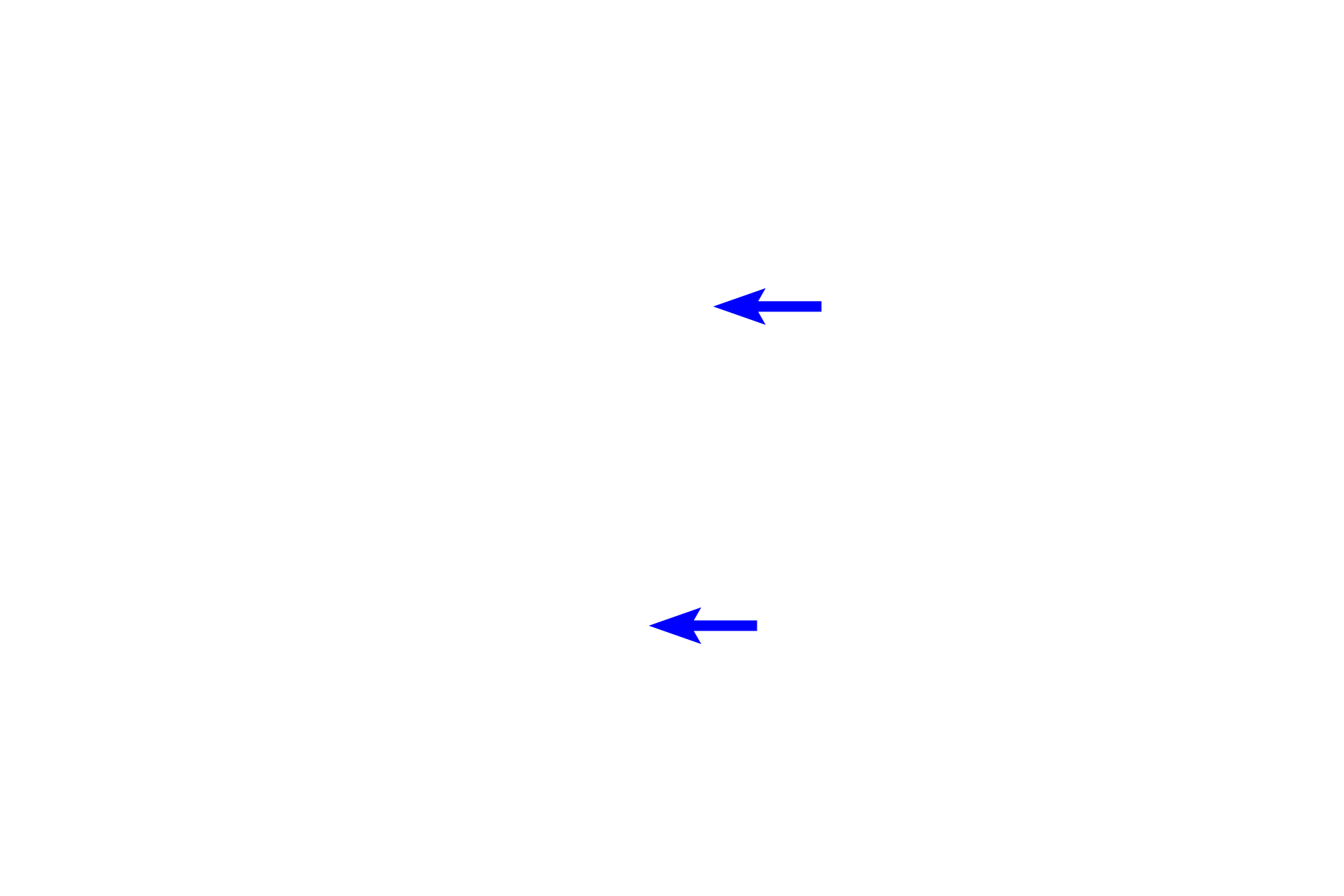 Diplosome <p>In mitotic cells, diplosomes produce the spindle apparatus, which is responsible for segregating chromosomes into the daughter cells.  Prior to mitosis, the diplosomes replicate and each pair migrates to opposite poles of the nucleus.  Microtubules extend from the centrioles and contact the sister chromatids.  Whitefish blastula  1500x</p>
