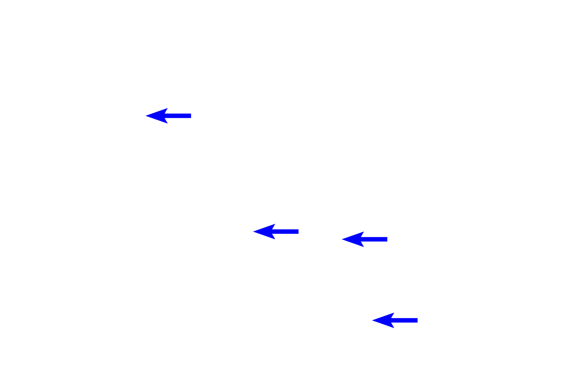 Red blood cells <p>Most cells have a single nucleus; however, as seen in this blood smear, mature red blood cells are unique in that they have no nucleus.  Also present are much less numerous white blood cells, which can have a variety of nuclear shapes. The two white blood cells, polymorphonuclear neutrophils (PMNs), seen here have multi-lobed nuclei.  1000x</p>

