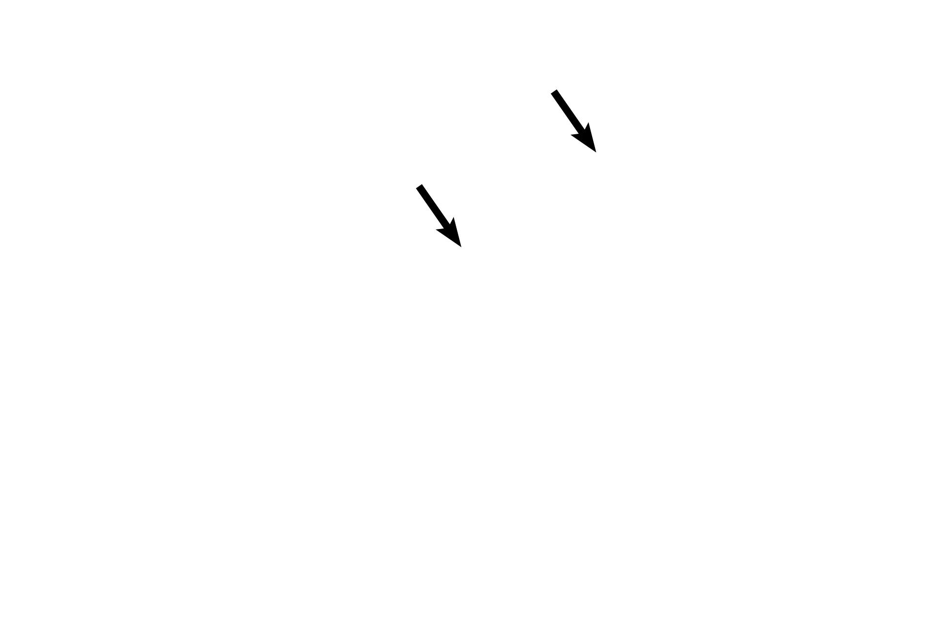 Vestibular  membrane <p>The cochlear duct, part of the membranous labyrinth, is a triangular-shaped wedge located in the cochlea. The cochlear duct, filled with endolymph, lies in the middle of the cochlea, dividing it into thirds, with the scala vestibuli above and the scala tympani below the cochlear duct. The organ of Corti, the receptor for sound, is housed in the cochlear duct.</p>
