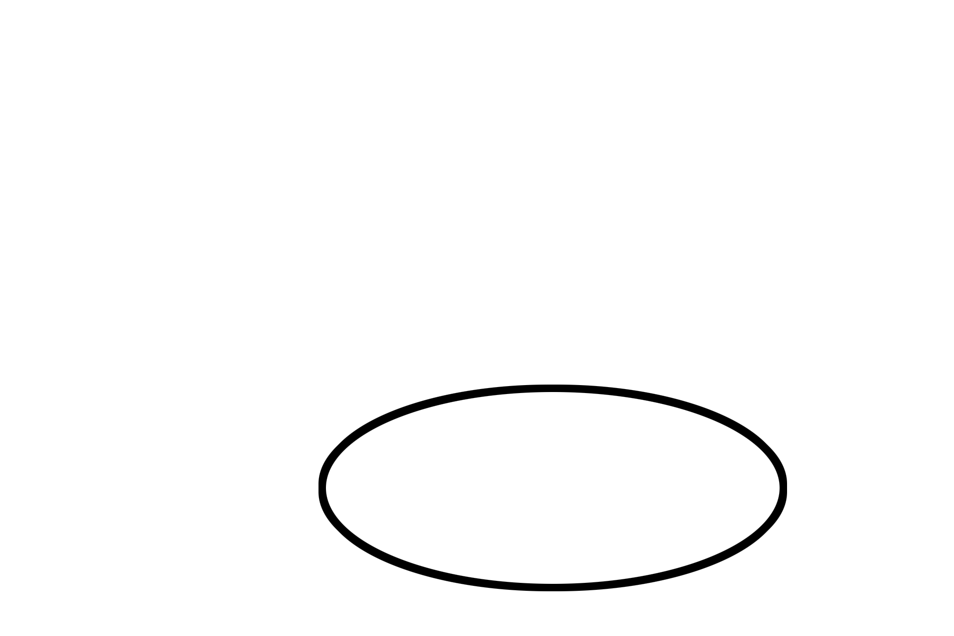  - Organ of Corti > <p>The organ of Corti consists of a complex of supportive cells and hair cells with elongated microvilli (stereocilia). Some of the stereocilia are embedded in the tectorial membrane, extending laterally over the organ of Corti. This membrane is frequently displaced during tissue preparation and, therefore, is not always seen in its proper location.</p>

