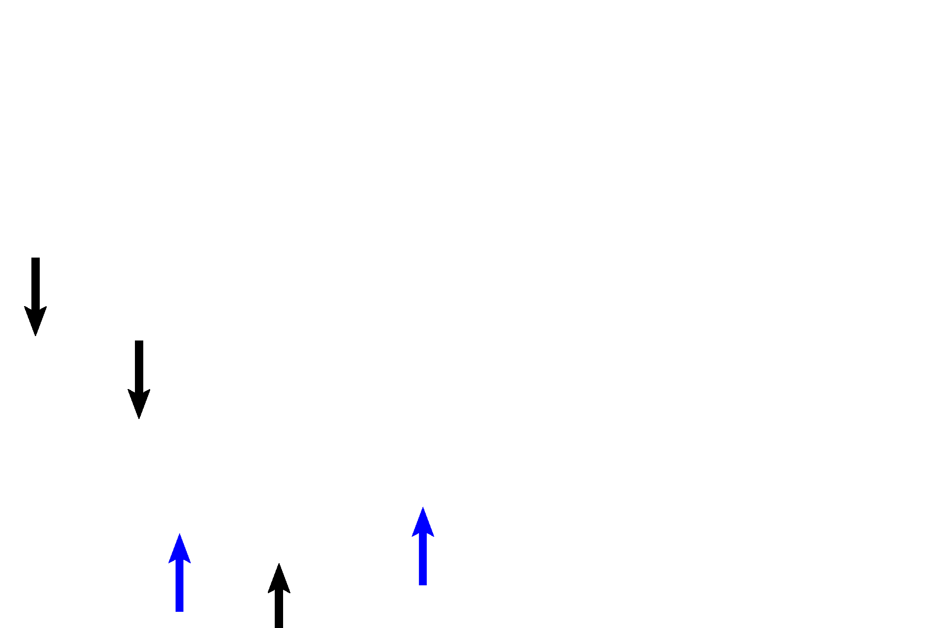 CN VIII > <p>Cranial nerve VIII innervates the hair cells. Peripheral axons (blue arrows) of this nerve pass medially from the hair cells through the osseous spiral lamina (black arrows) to the spiral ganglion, where their bipolar nerve cell bodies are located. Central processes of these neurons form the cochlear division of the nerve.</p>
