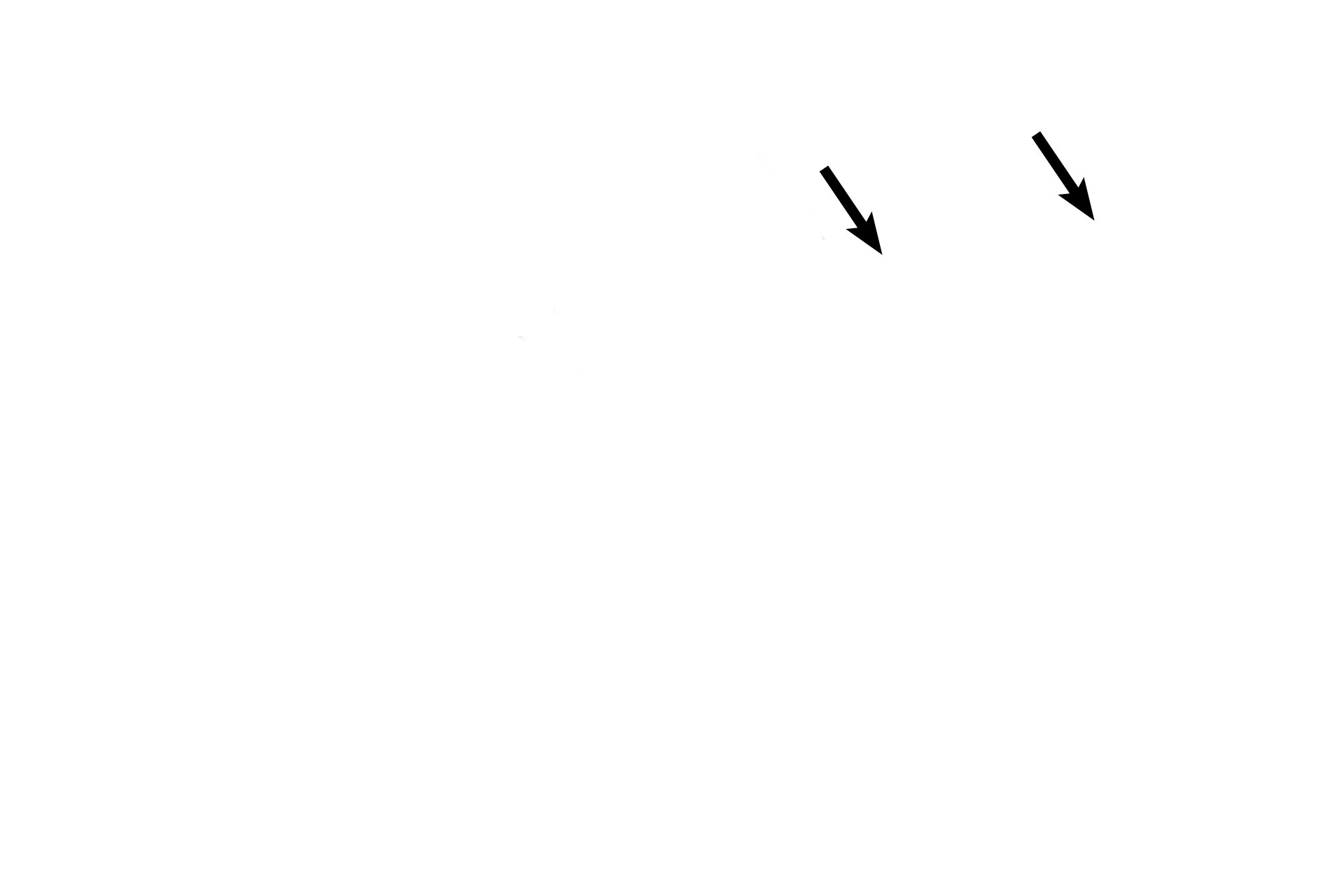 Vestibular membrane <p>An illustration and a histological section of a single turn of the osseous cochlea show the cochlear duct positioned between the scala vestibuli and scala tympani. The receptor for hearing, the organ of Corti, is located on the basilar membrane (floor) of the cochlear duct. 100x</p>

