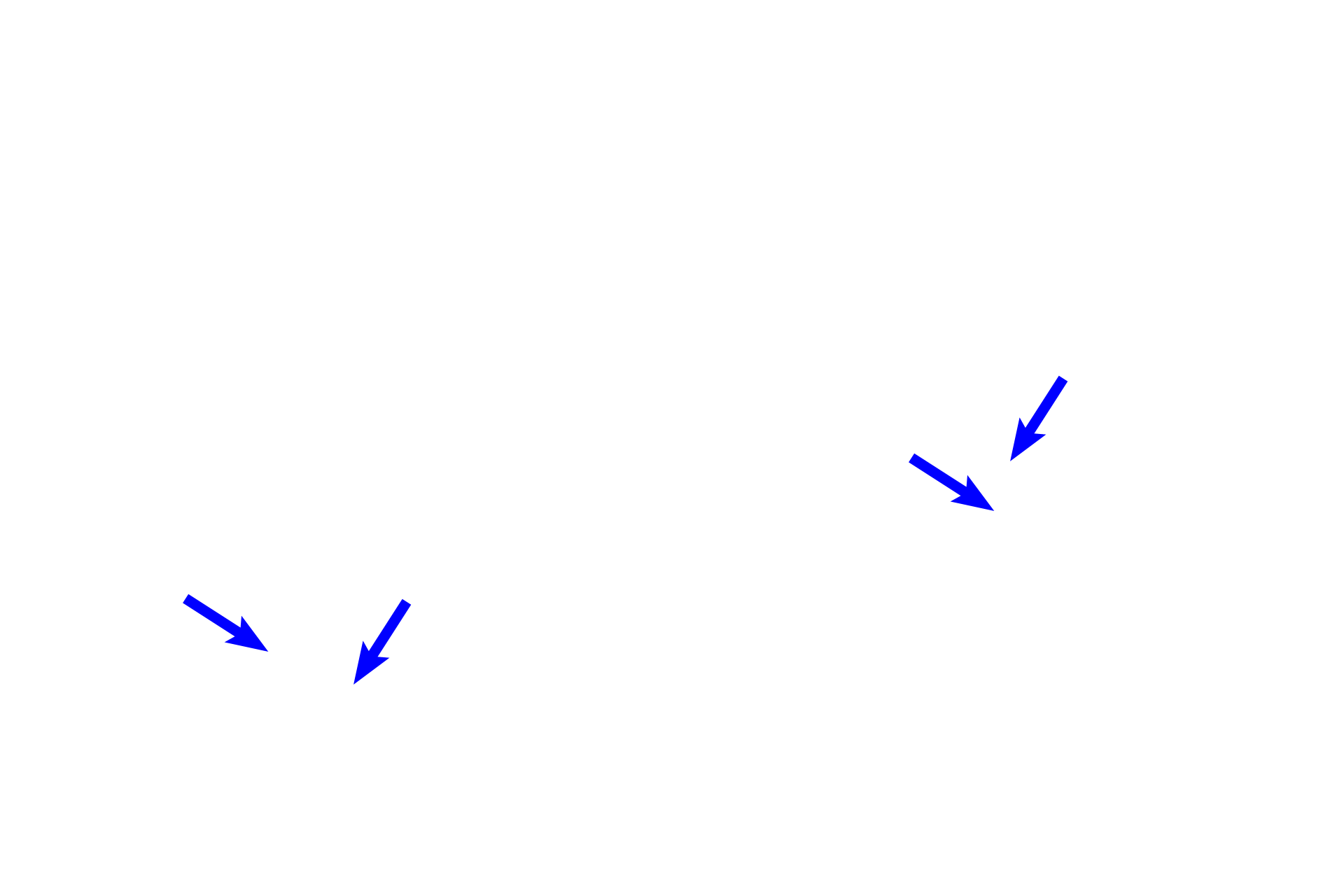  -- Hair cells <p>An illustration and a histological section of a single turn of the osseous cochlea show the cochlear duct positioned between the scala vestibuli and scala tympani. The receptor for hearing, the organ of Corti, is located on the basilar membrane (floor) of the cochlear duct. 100x</p>
