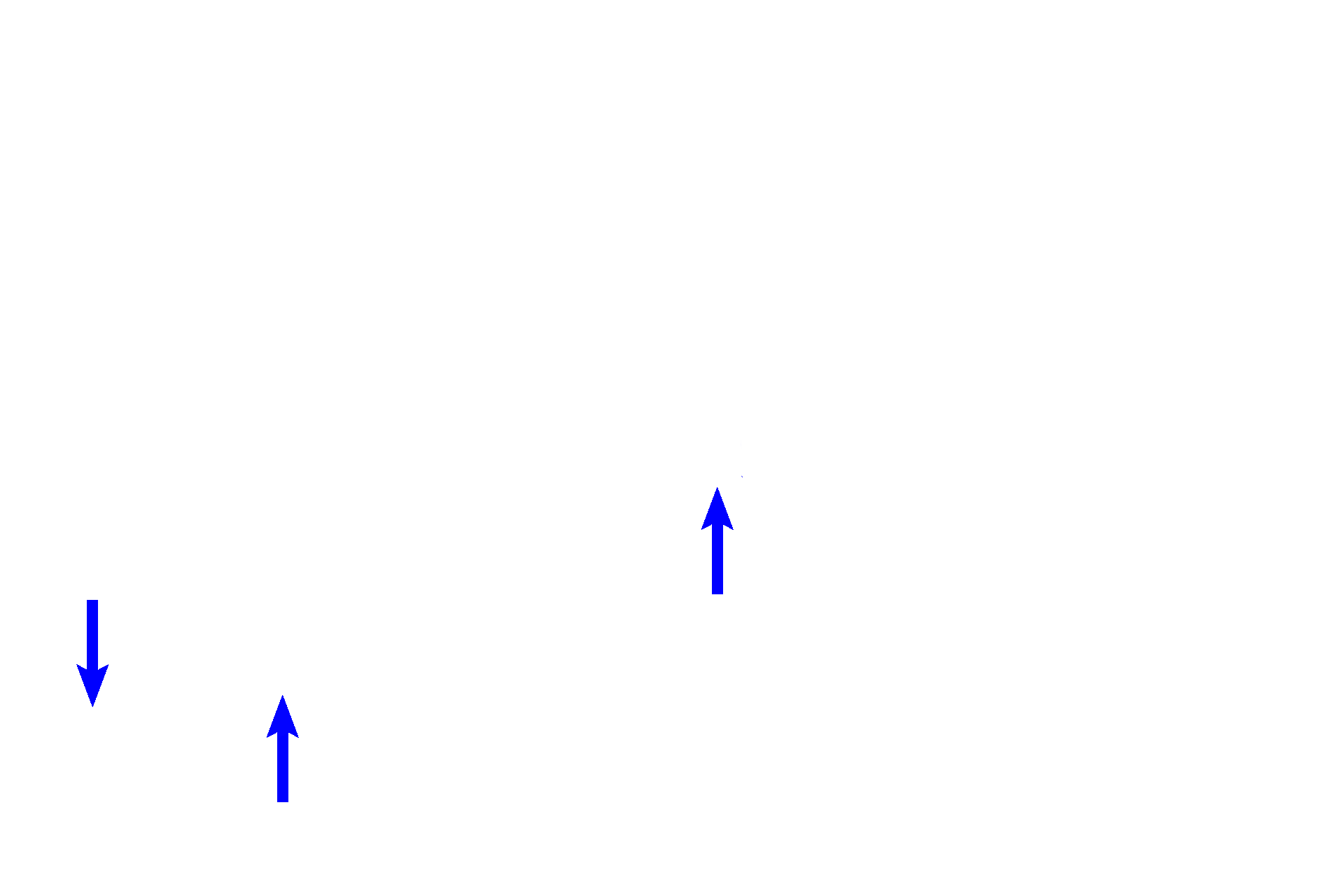 Cranial nerve VIII <p>An illustration and a histological section of a single turn of the osseous cochlea show the cochlear duct positioned between the scala vestibuli and scala tympani. The receptor for hearing, the organ of Corti, is located on the basilar membrane (floor) of the cochlear duct. 100x</p>

