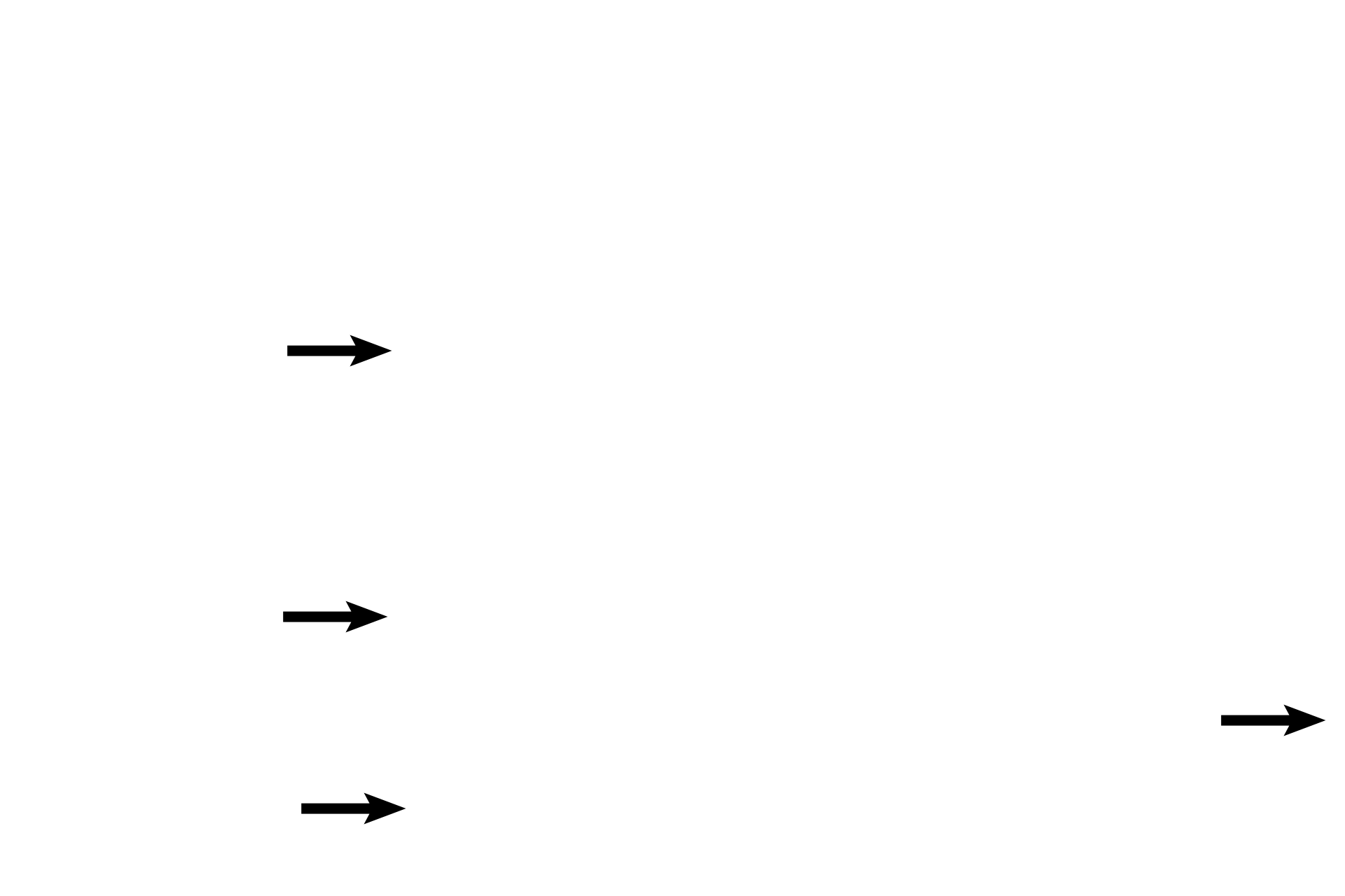 CN VIII <p>Peripheral dendrites of the vestibulocochlear nerve (CN VIII) innervate hair cells of the organ of Corti and then pass medially through the osseous spiral lamina to the spiral ganglion, location of their bipolar nerve cell bodies. Central axons form the cochlear division of the nerve. The modiolus with its osseous spiral lamina provides a framework for the cochlea and a conduit for the nerve. 40x, 200x.</p>
