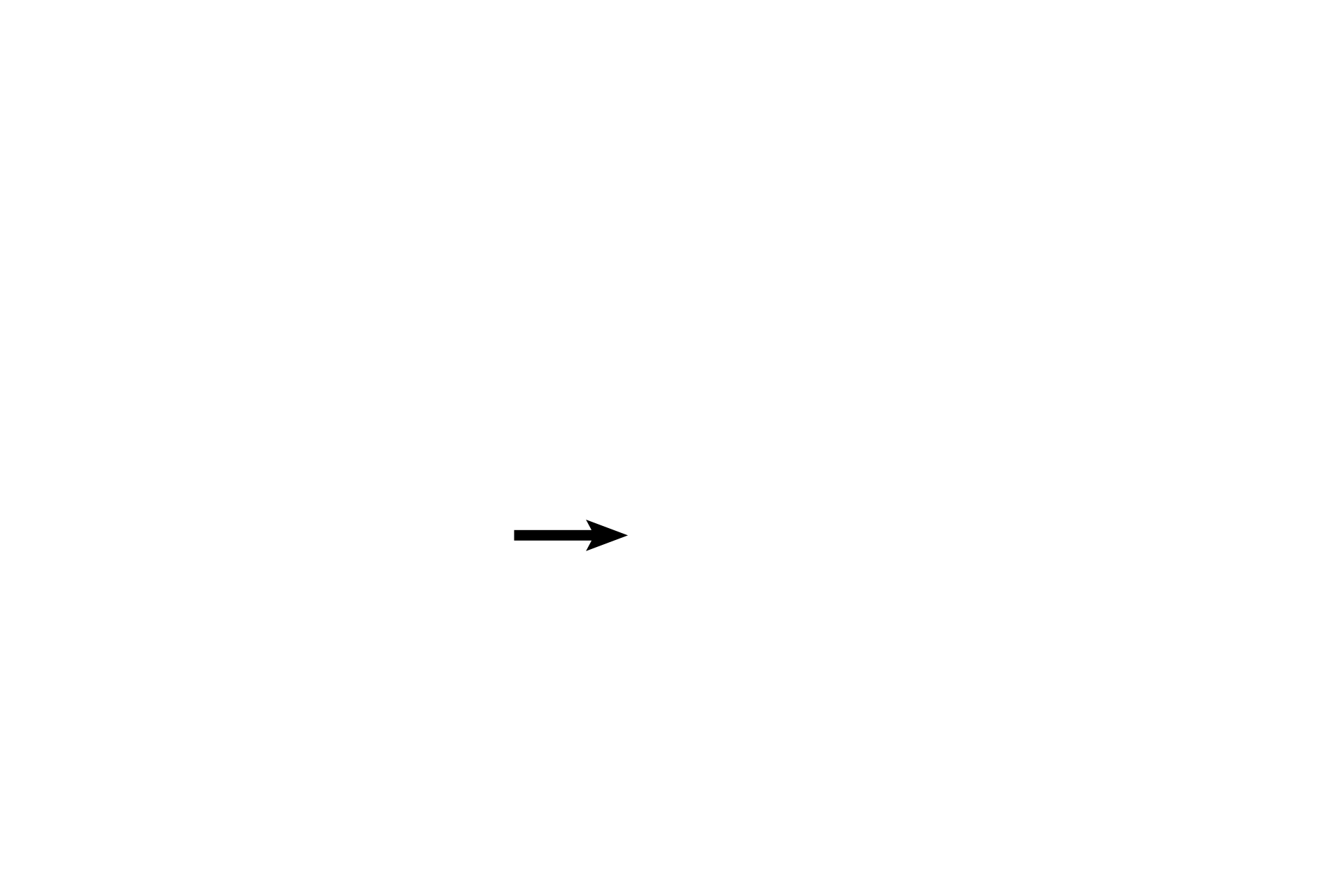 Saccule > <p>The saccule of the membranous labyrinth is a smaller chamber housed within the vestibule of the osseous labyrinth. The receptor it contains, the macula, also responds to stimuli of linear acceleration and gravitational forces. The saccule is connected by small ducts to the utricle and to the cochlear duct.</p>
