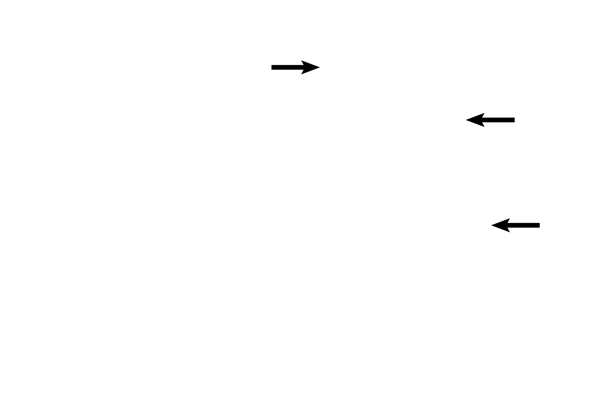 Semicircular ducts > <p>The semicircular ducts of the membranous labyrinth are three tubes housed within the semicircular canals of the osseous labyrinth. Each duct contains a receptor, a crista ampullaris, that responds to angular acceleration. Each crista is located within an enlargement, the ampulla, situated adjacent to the utricle. The semicircular ducts connect with the utricle.</p>
