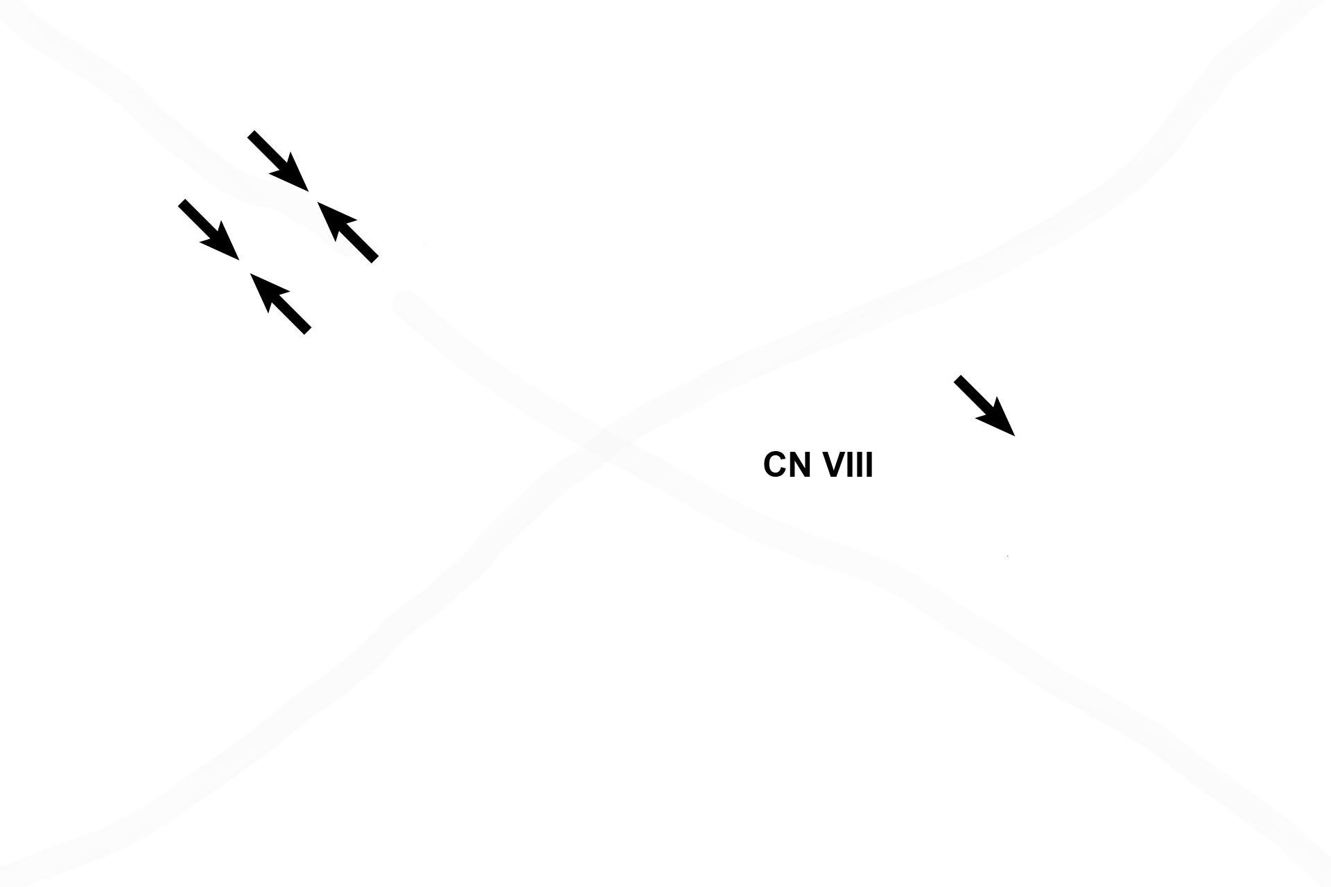  - Utricular macula <p>The utricle is a portion of the membranous labyrinth located in the vestibule. A thickening in the epithelial lining of the utricle forms the macula, a neuroepithelial receptor, innervated by the vestibular division of cranial nerve VIII. The macula of the saccule would be identical to that shown here in the utricle.</p>
