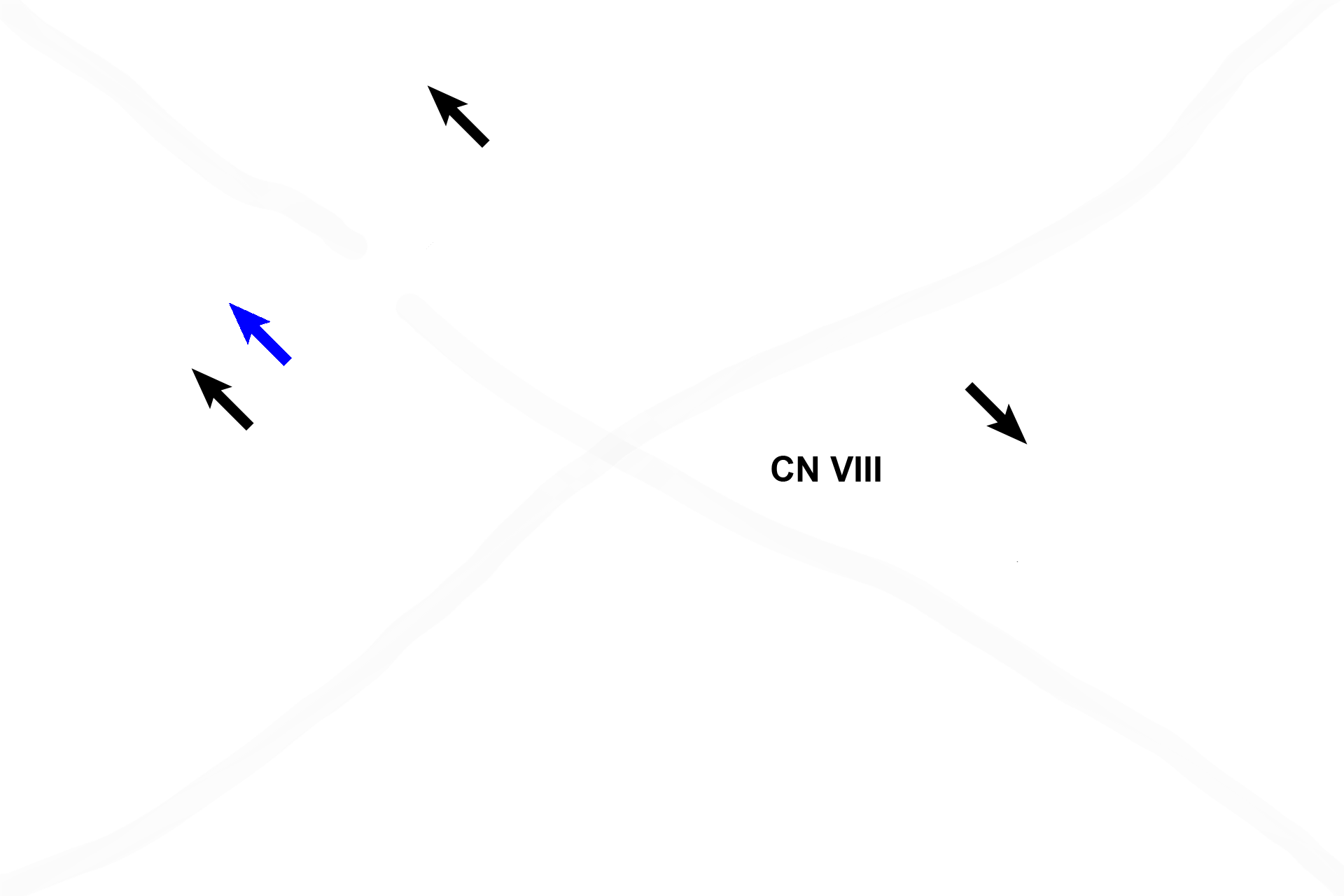  -- Macular components > <p>Each macula contains hair cells that possess stereocilia and a cilium, embedded in a gelatinous layer. Otoliths (blue arrow) are suspended at the surface of the gel. Cells of the planum semilunatum (black arrows) produce endolymph. Changes in gravity and linear motion displace the otoliths, which deflect the stereocilia and cilium, thereby initiating an impulse in CN VIII.</p>
