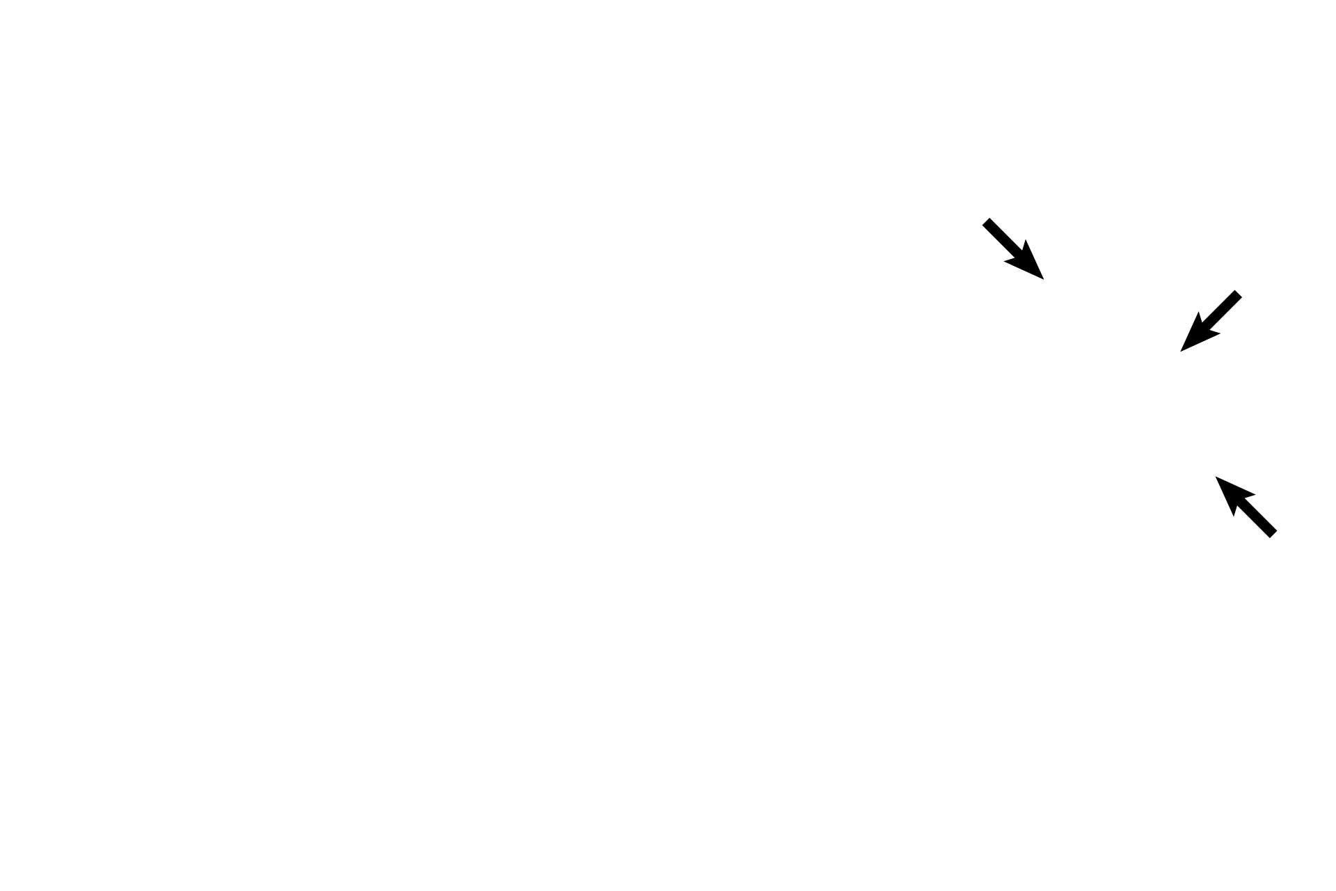 Semicircular ducts > <p>Each semicircular duct, suspended in its bony semicircular canal, is a circularly arranged tube; both ends of the tube join the utricle. An enlargement, the ampulla, at one end of the tube houses its receptor, the crista ampullaris.</p>
