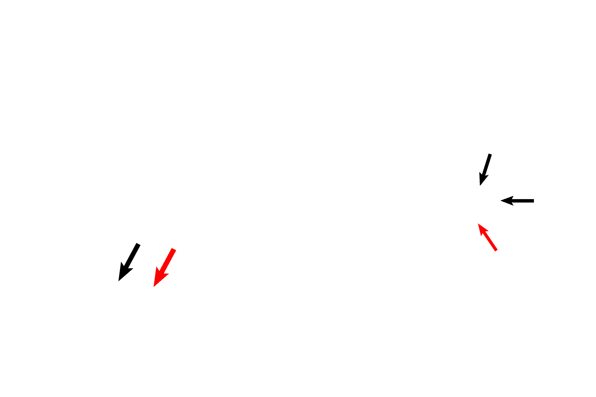  -- Cristae ampullares > <p>The ampulla, at one end of the semicircular duct houses the receptor, the crista ampullaris (black arrow). Each receptor possesses a gelatinous cupula (red arrow) that extends to the opposite wall of the ampulla.</p>
